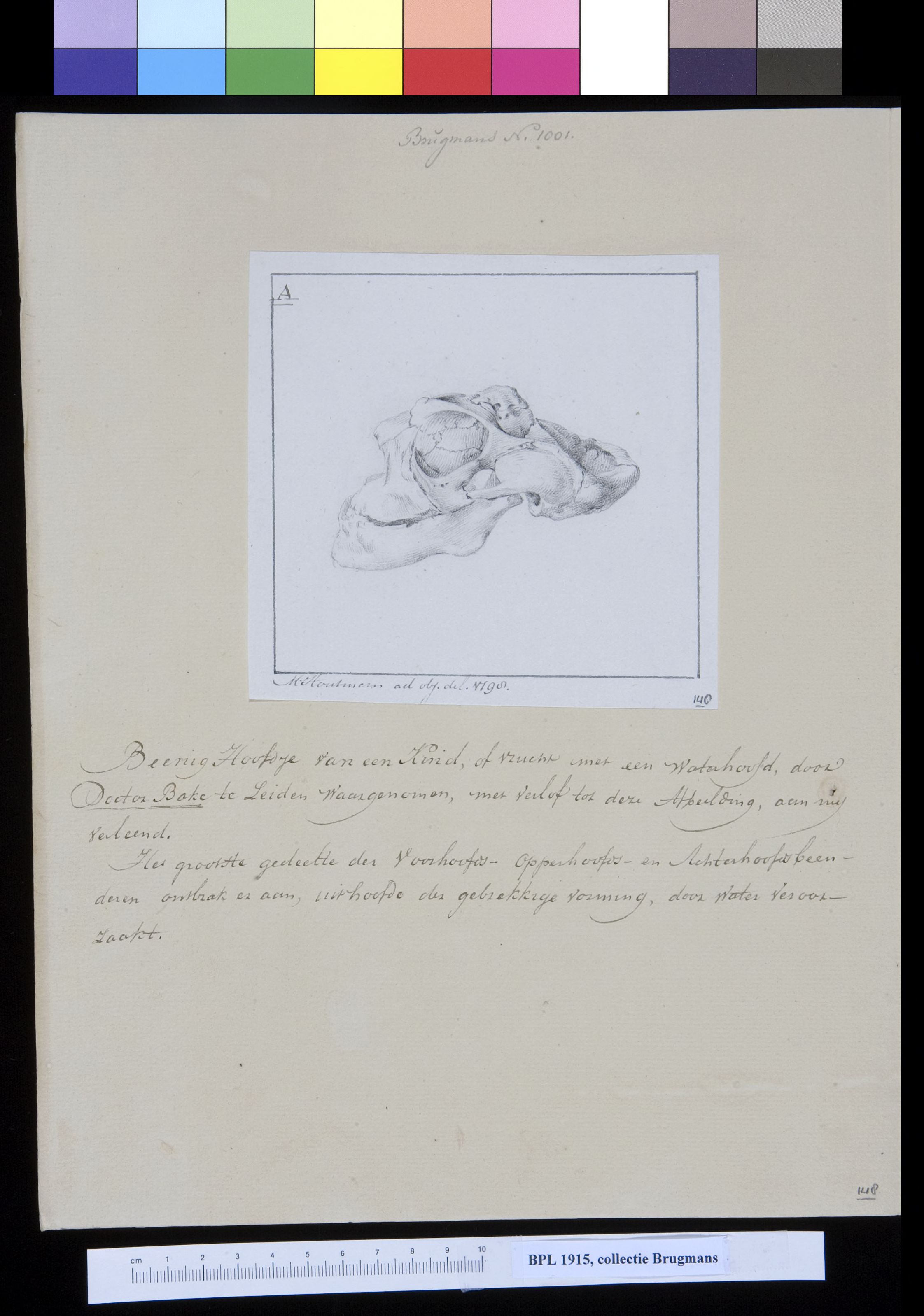 Skull of a child, lateral view