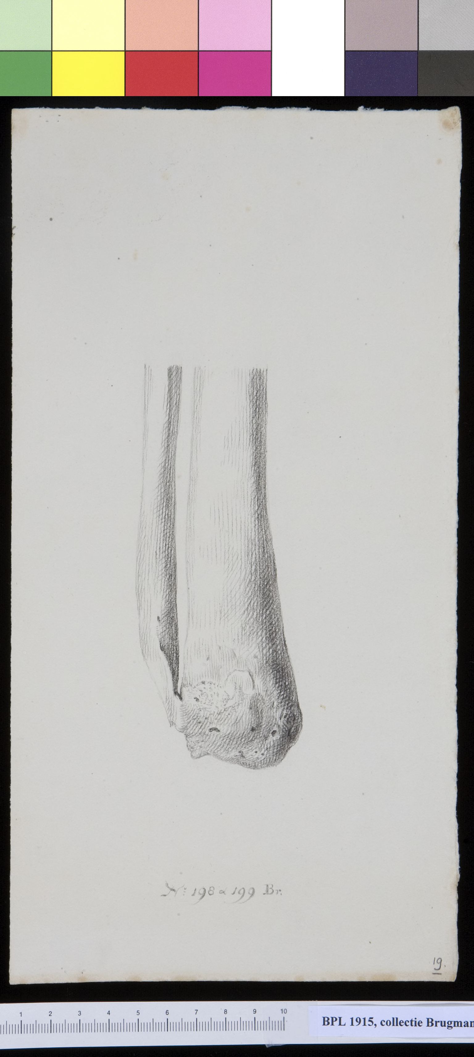 Bones of the lower leg (fubula and tibia)