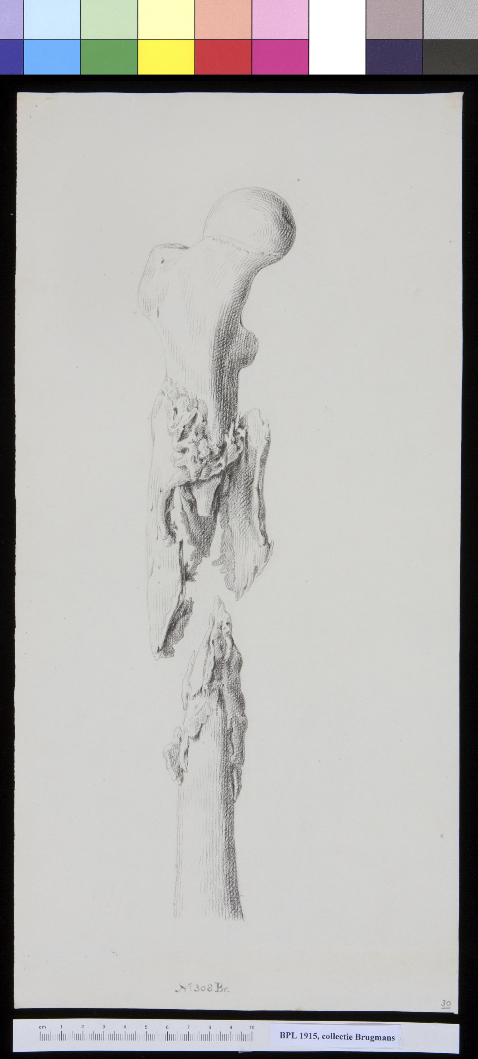 Bone of the upper leg (femur)