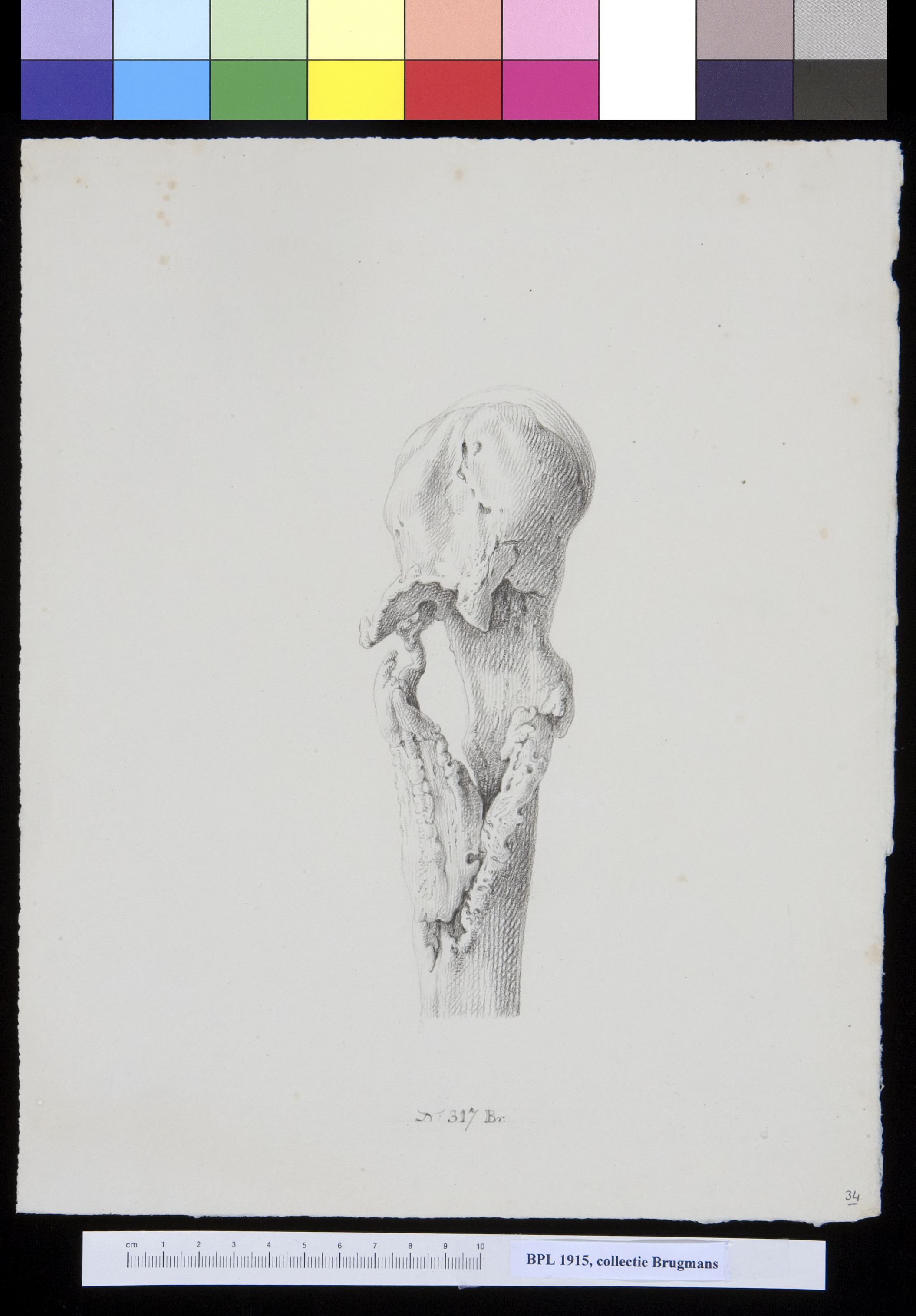 Bone of the upper leg (femur)