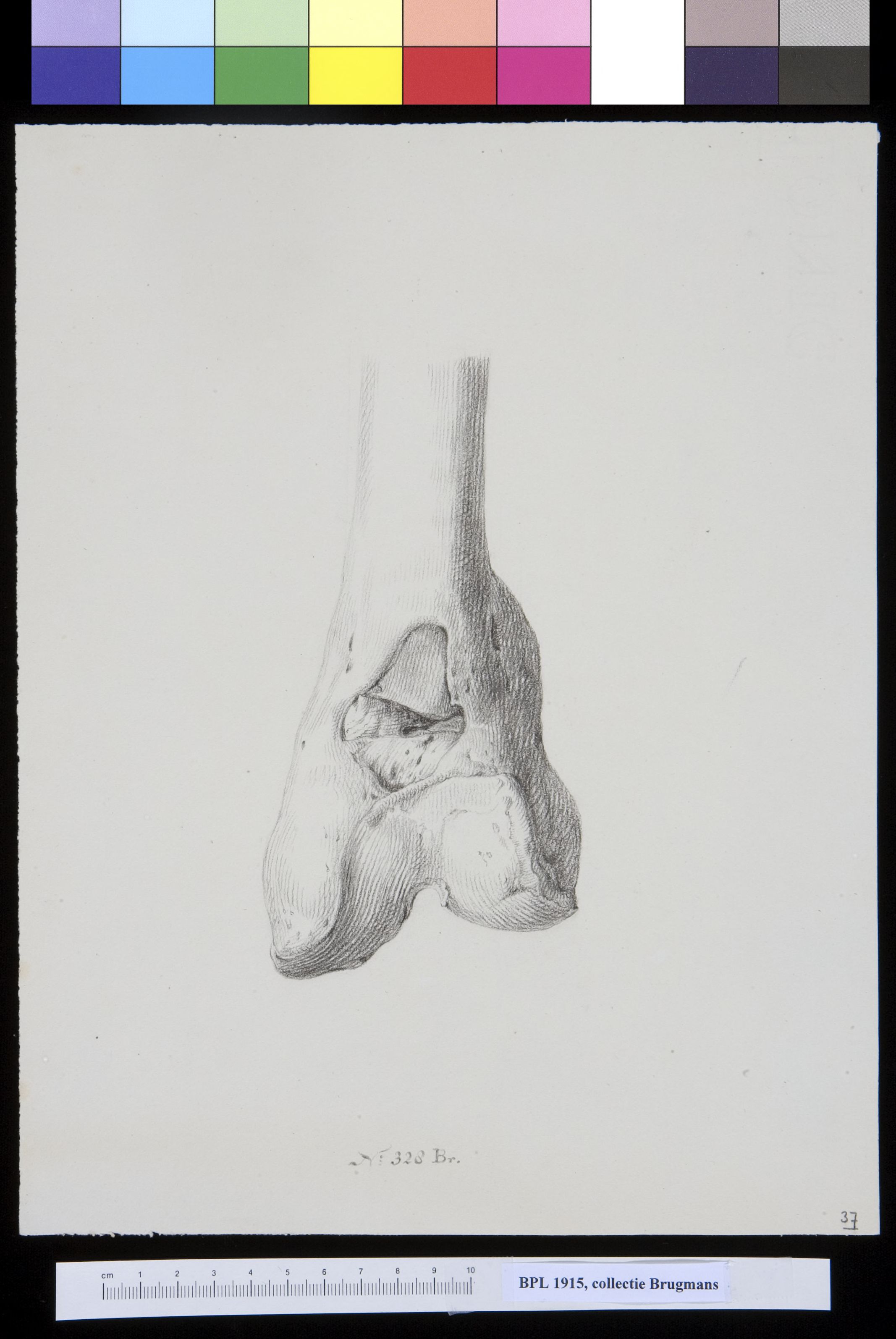 Bone of the leg