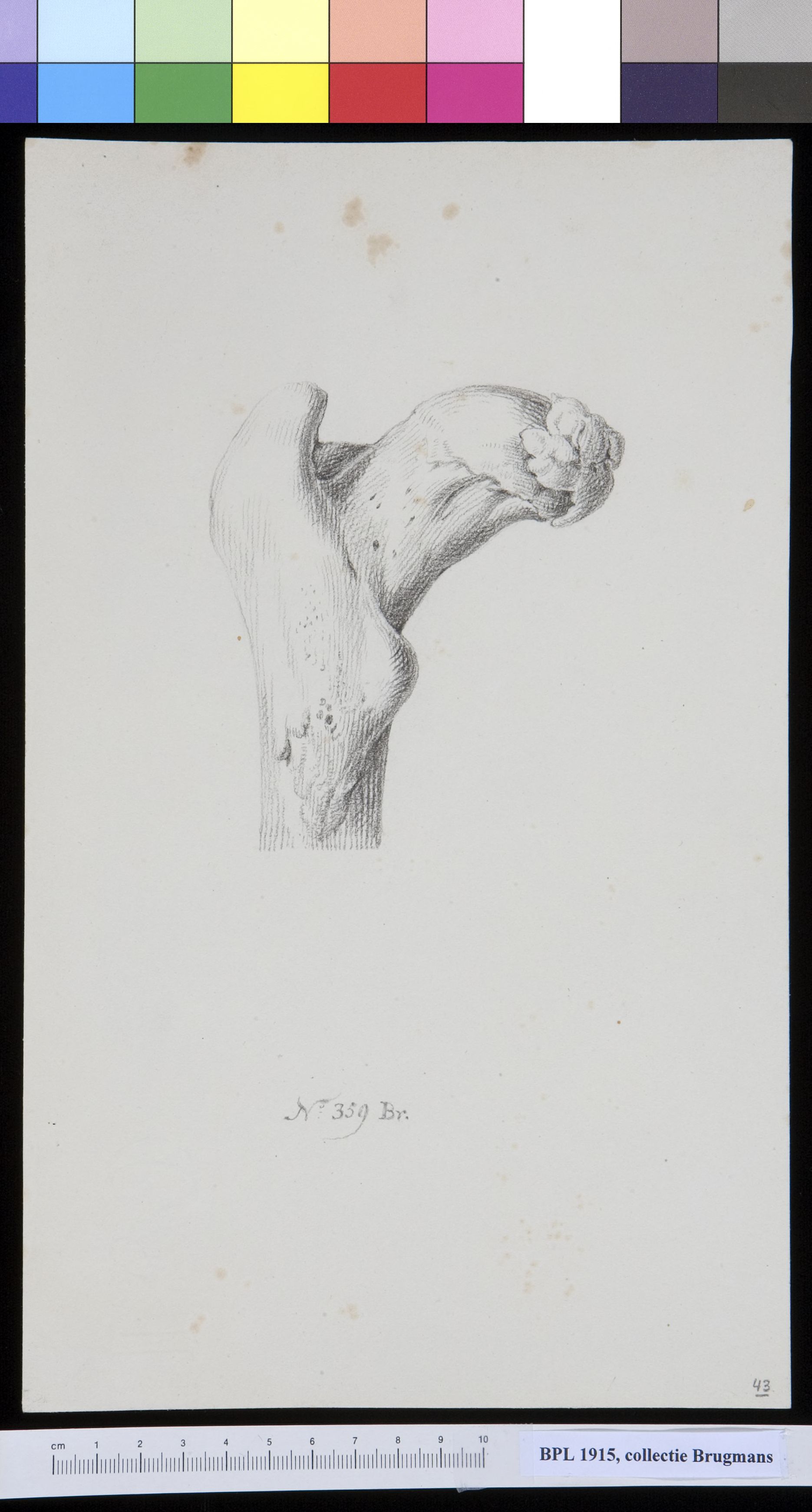 Bone of the upper leg (femur)