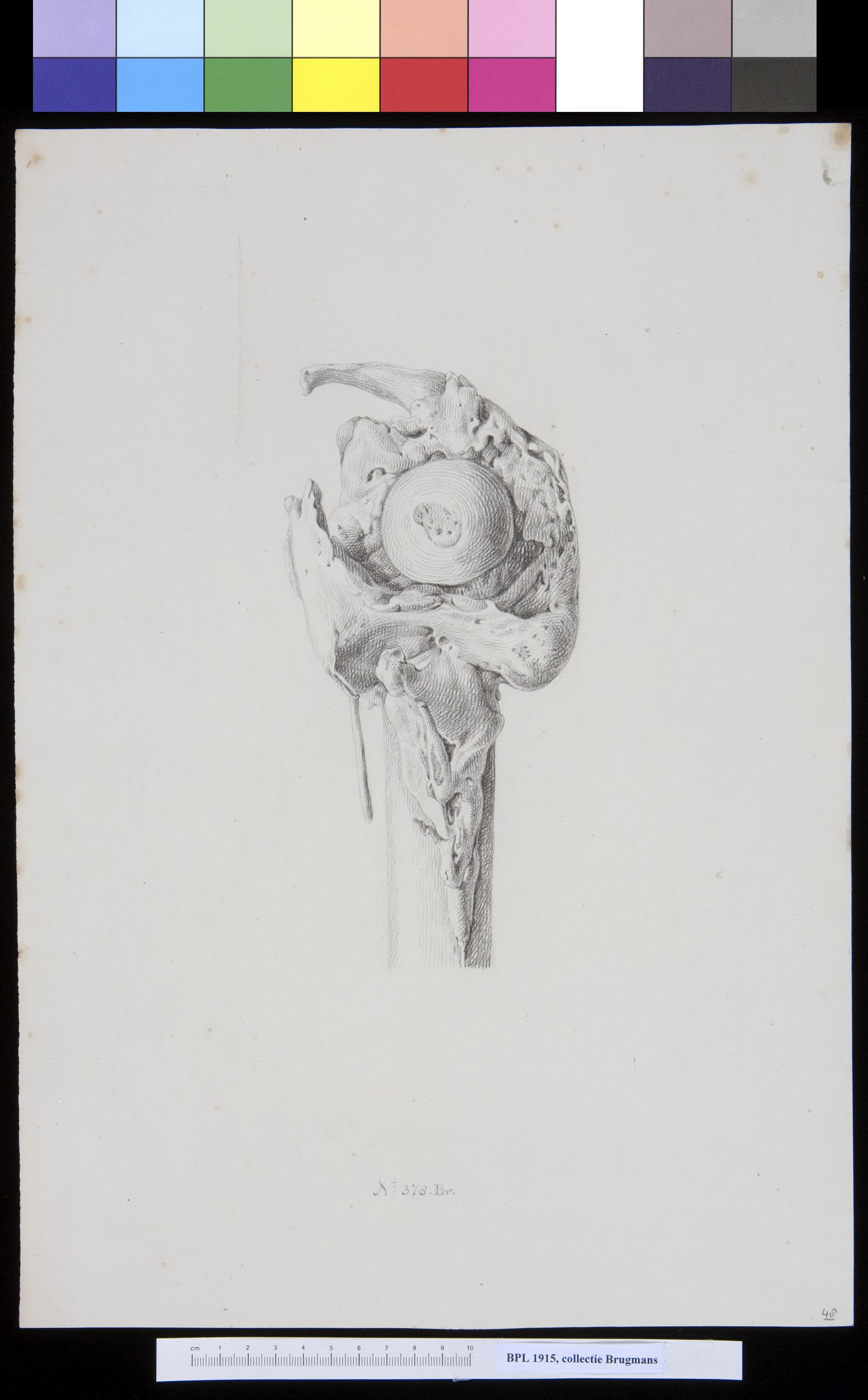 Bone of the upper leg (femur)