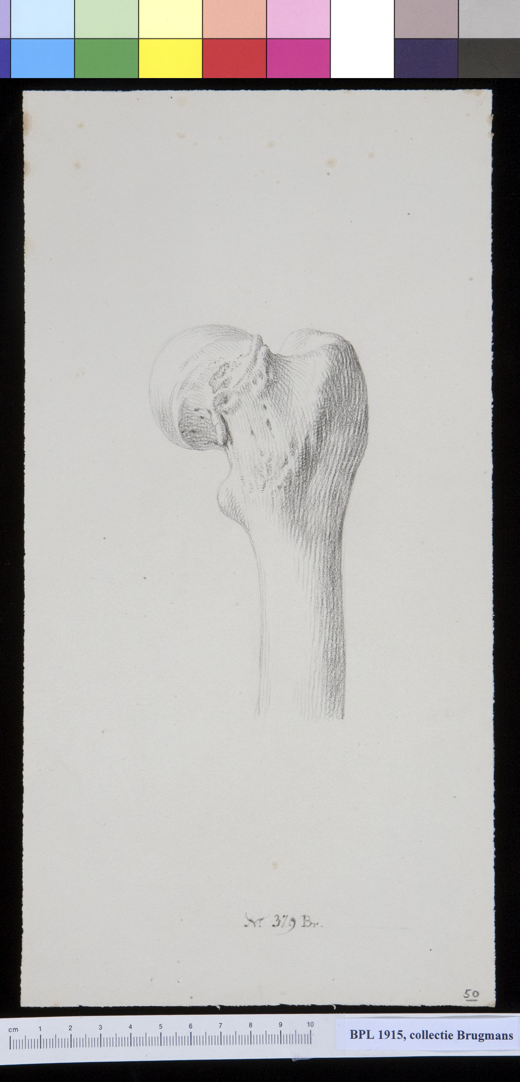 Bone of the upper leg (femur)