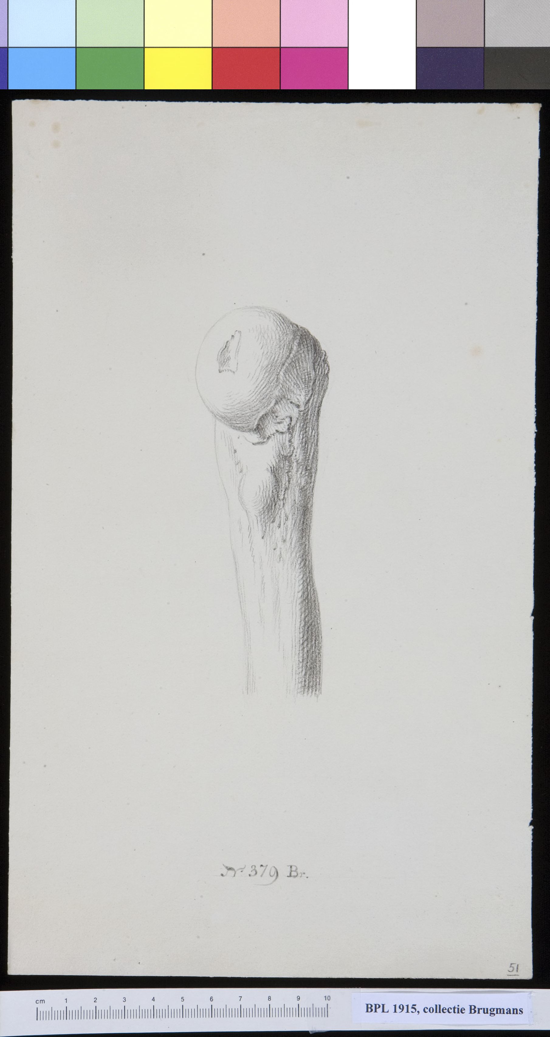 Bone of the upper leg (femur)