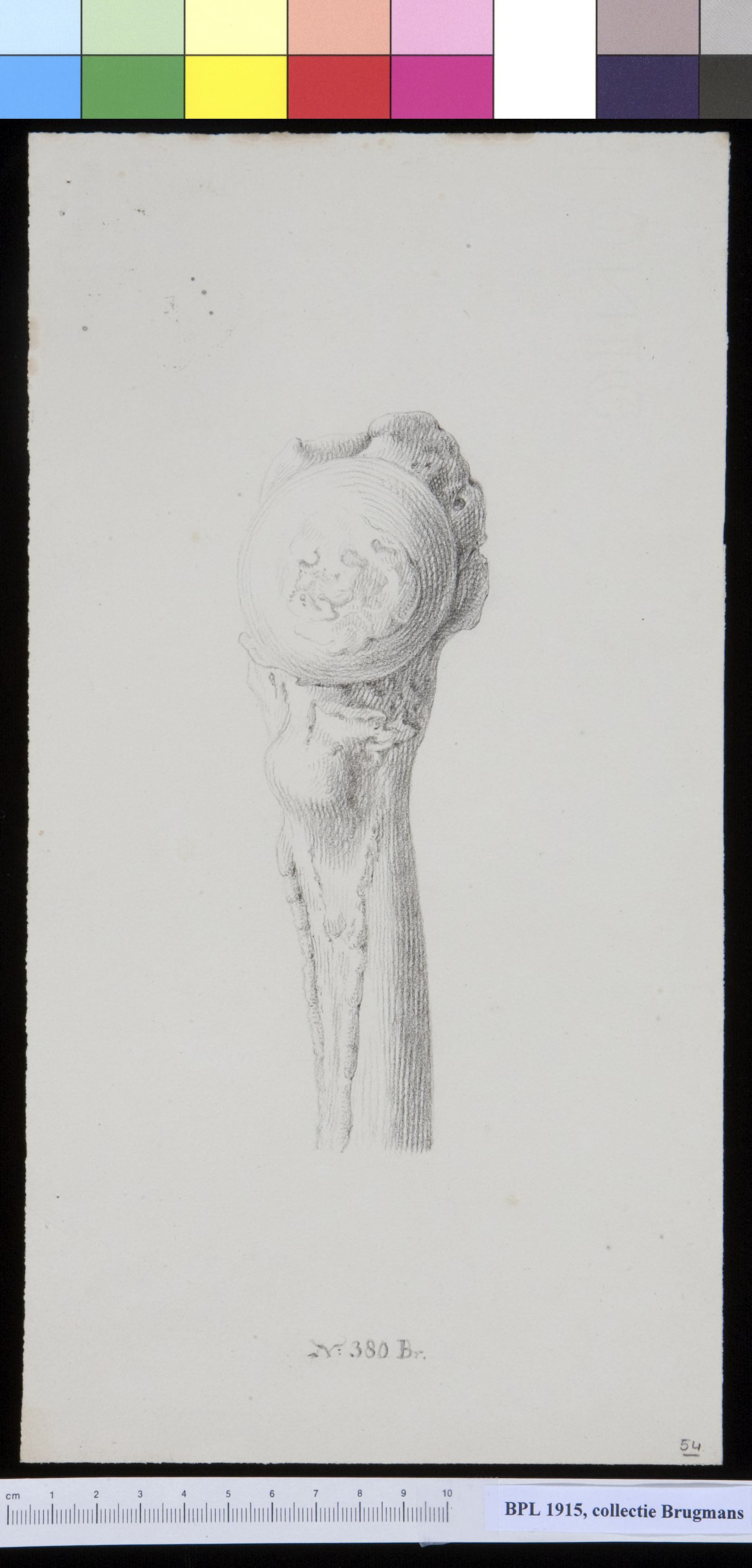 Bone of the upper leg (femur)