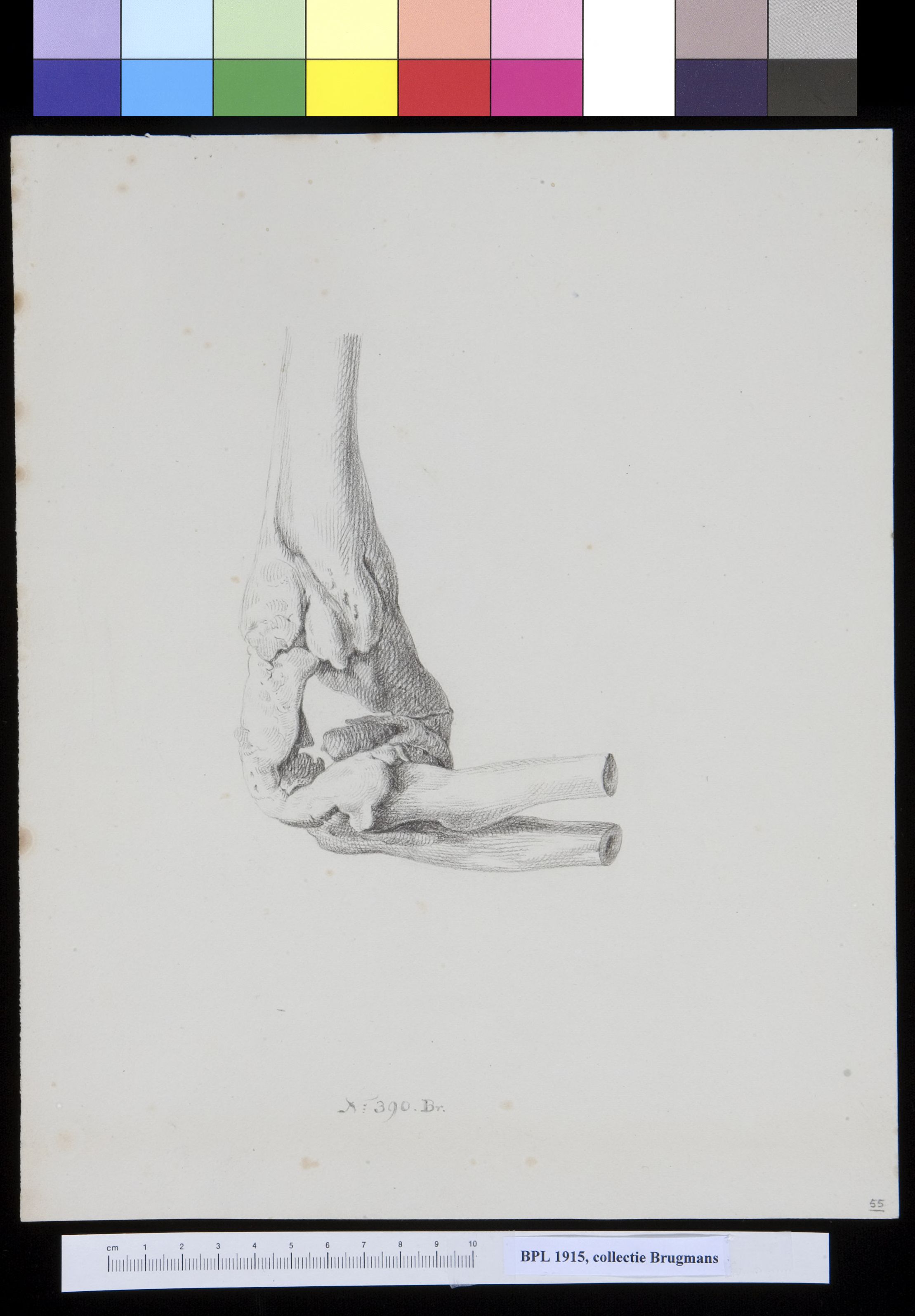 Bones of the elbow
