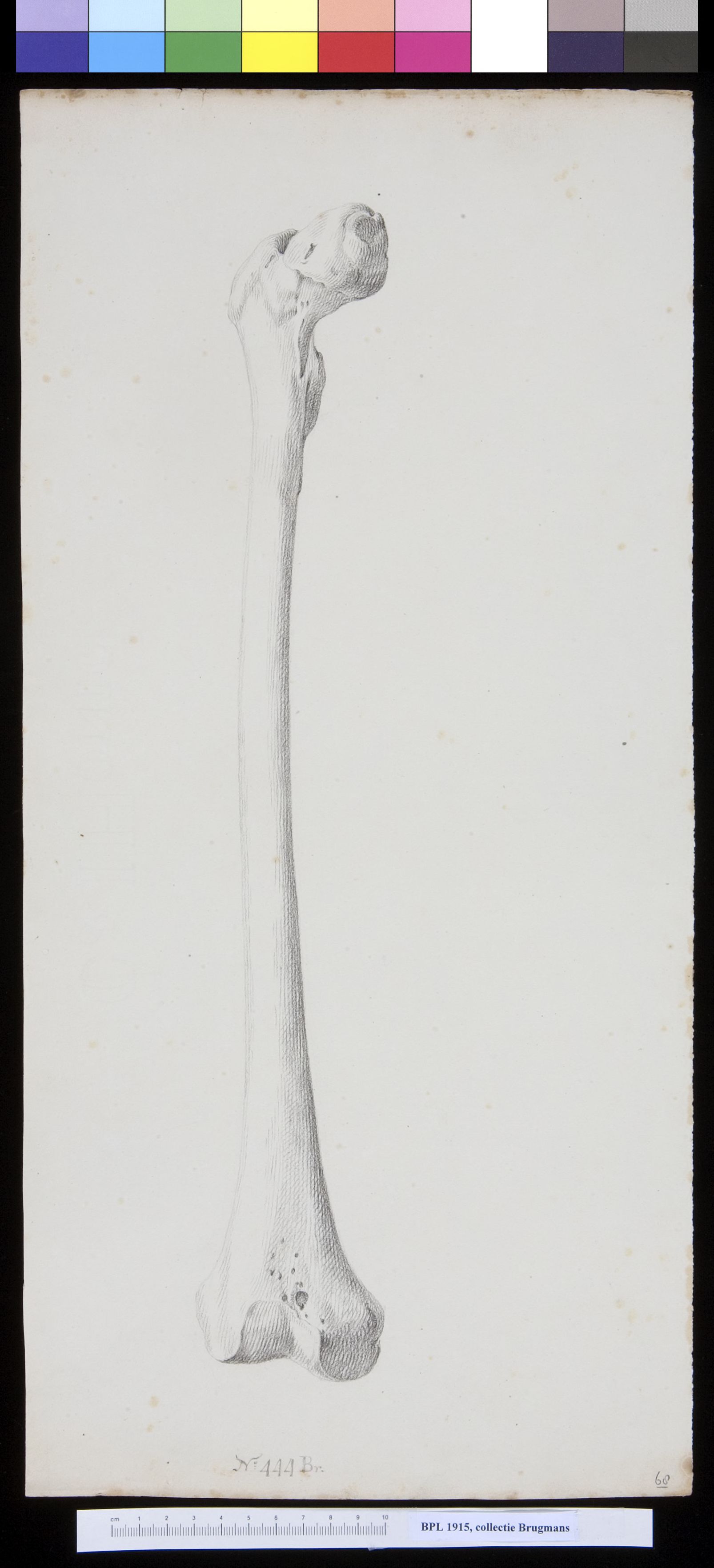 Bone of the upper leg (femur)