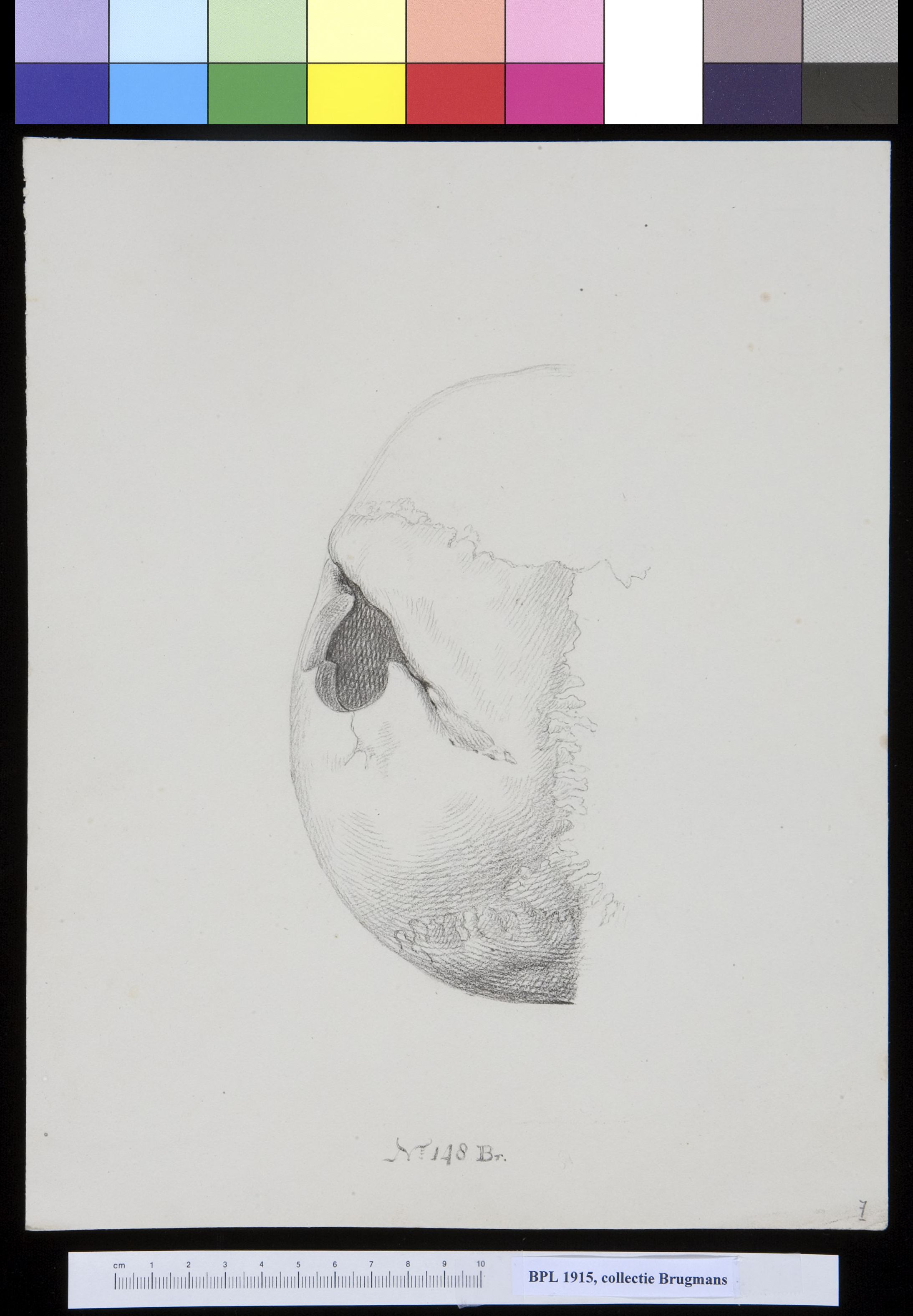 Skull with hole in the parietal bone