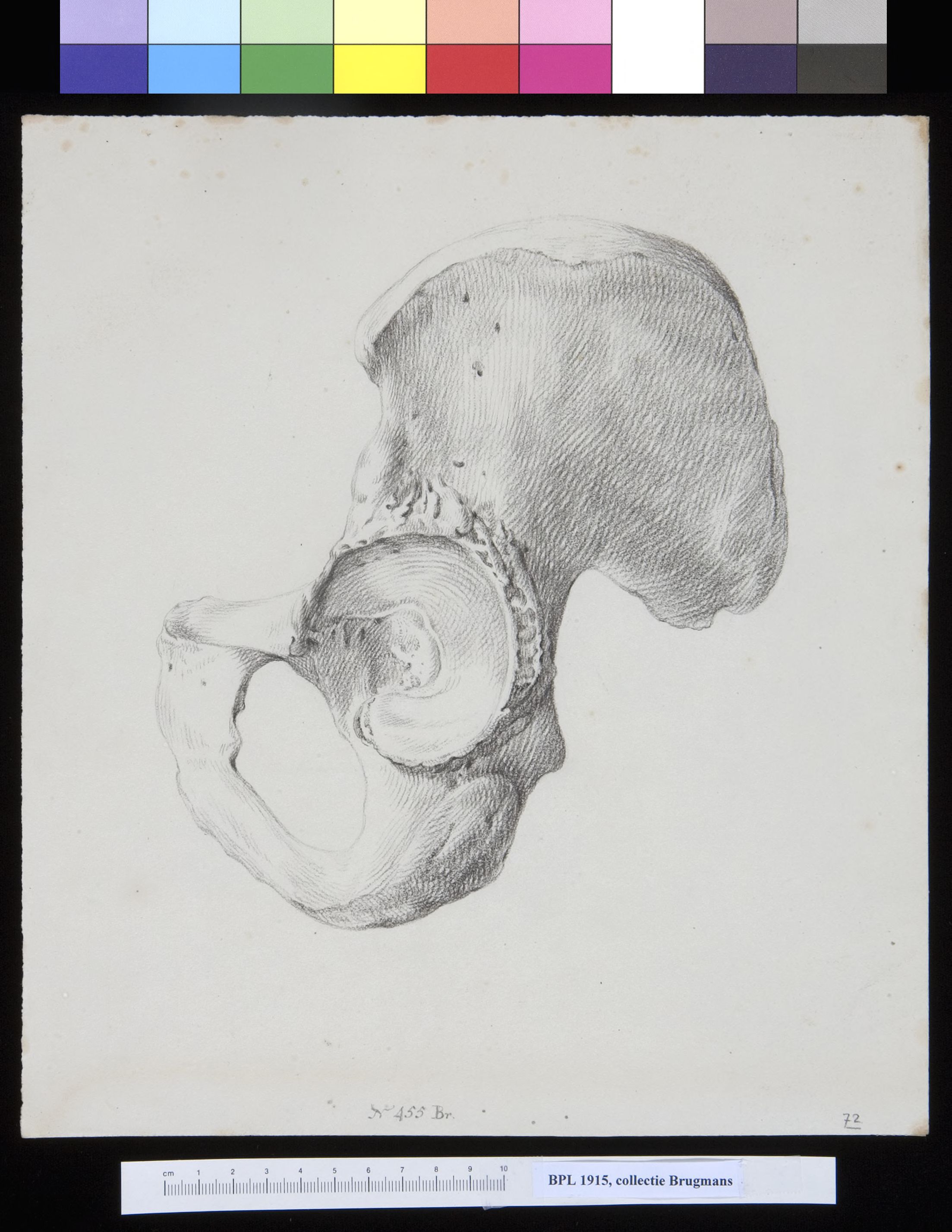 Pelvis
