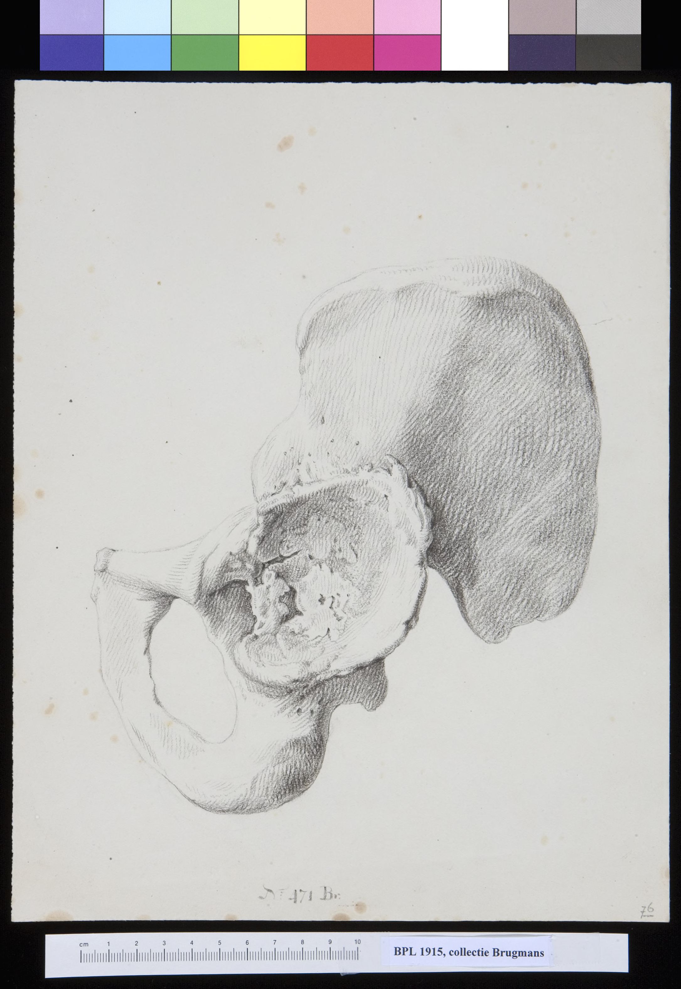 Pelvis