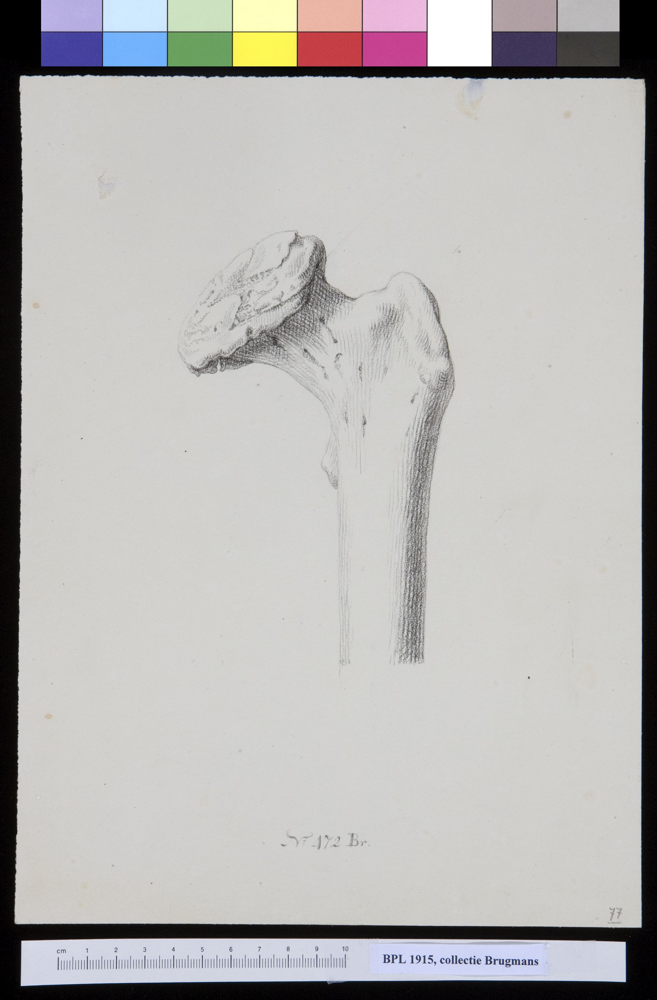 Bone of the upper leg (femur)