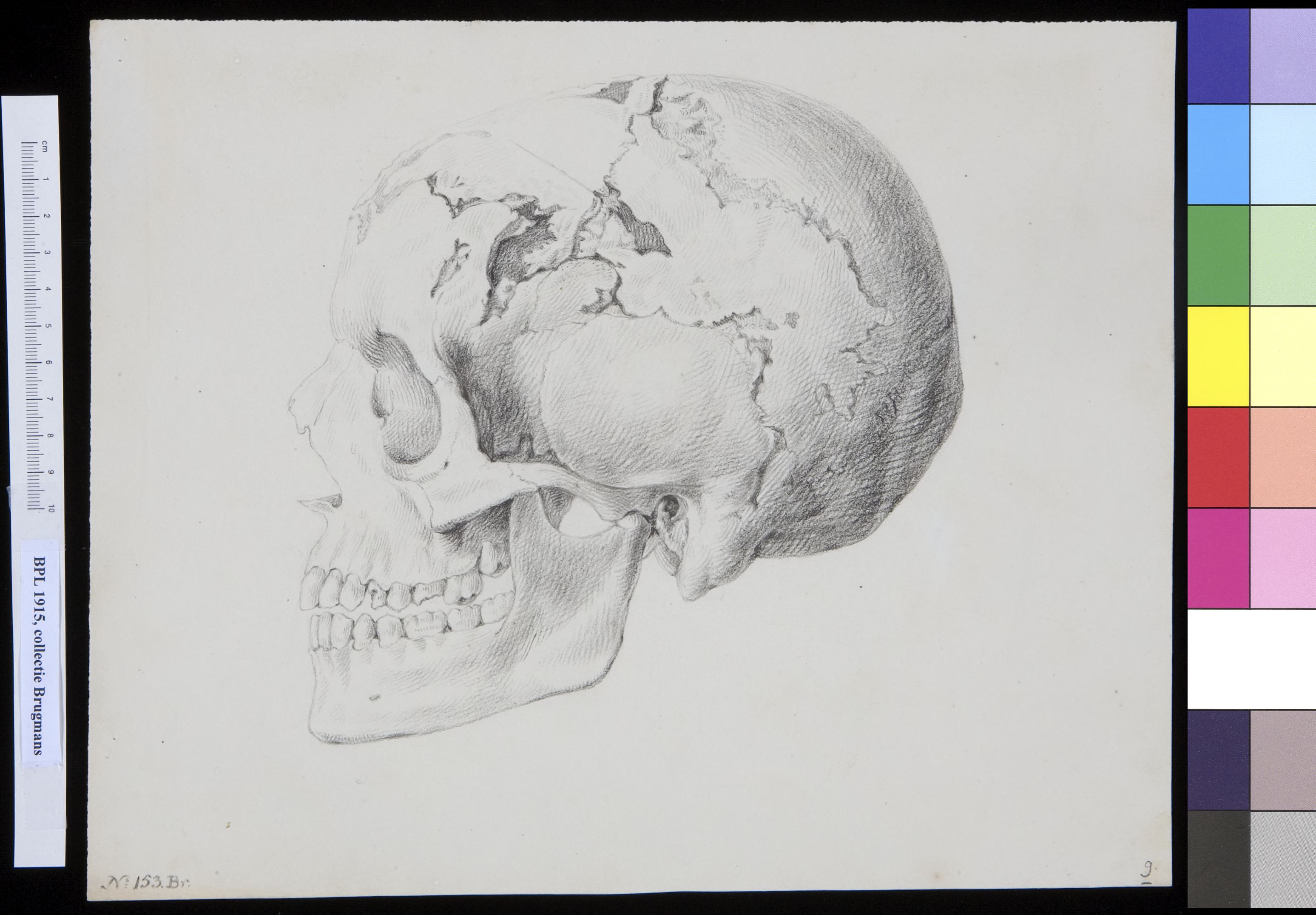 Skull with several holes, lateral view