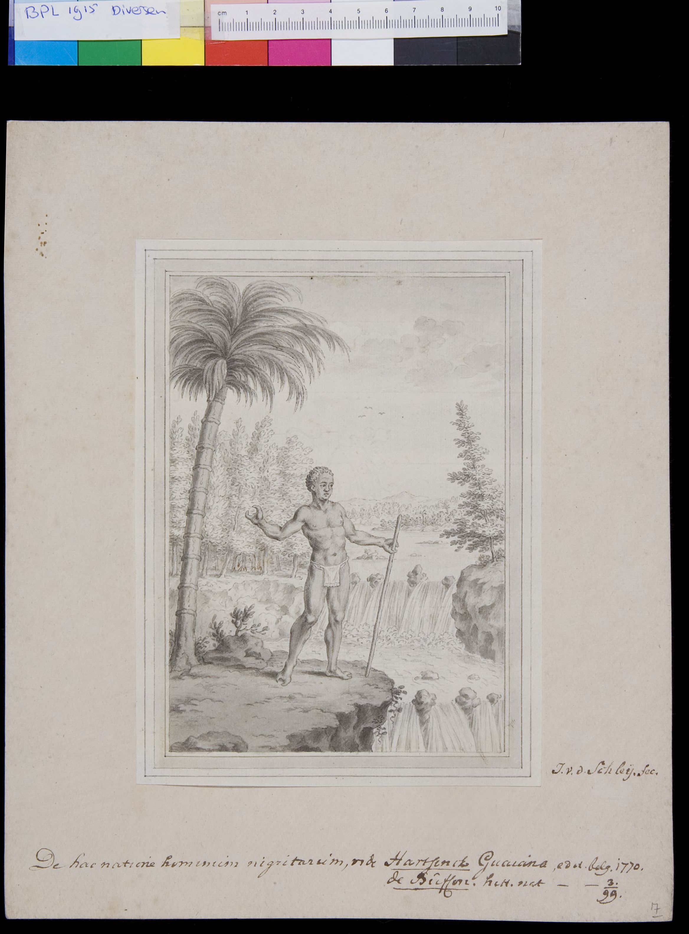 Black man with deformed hands