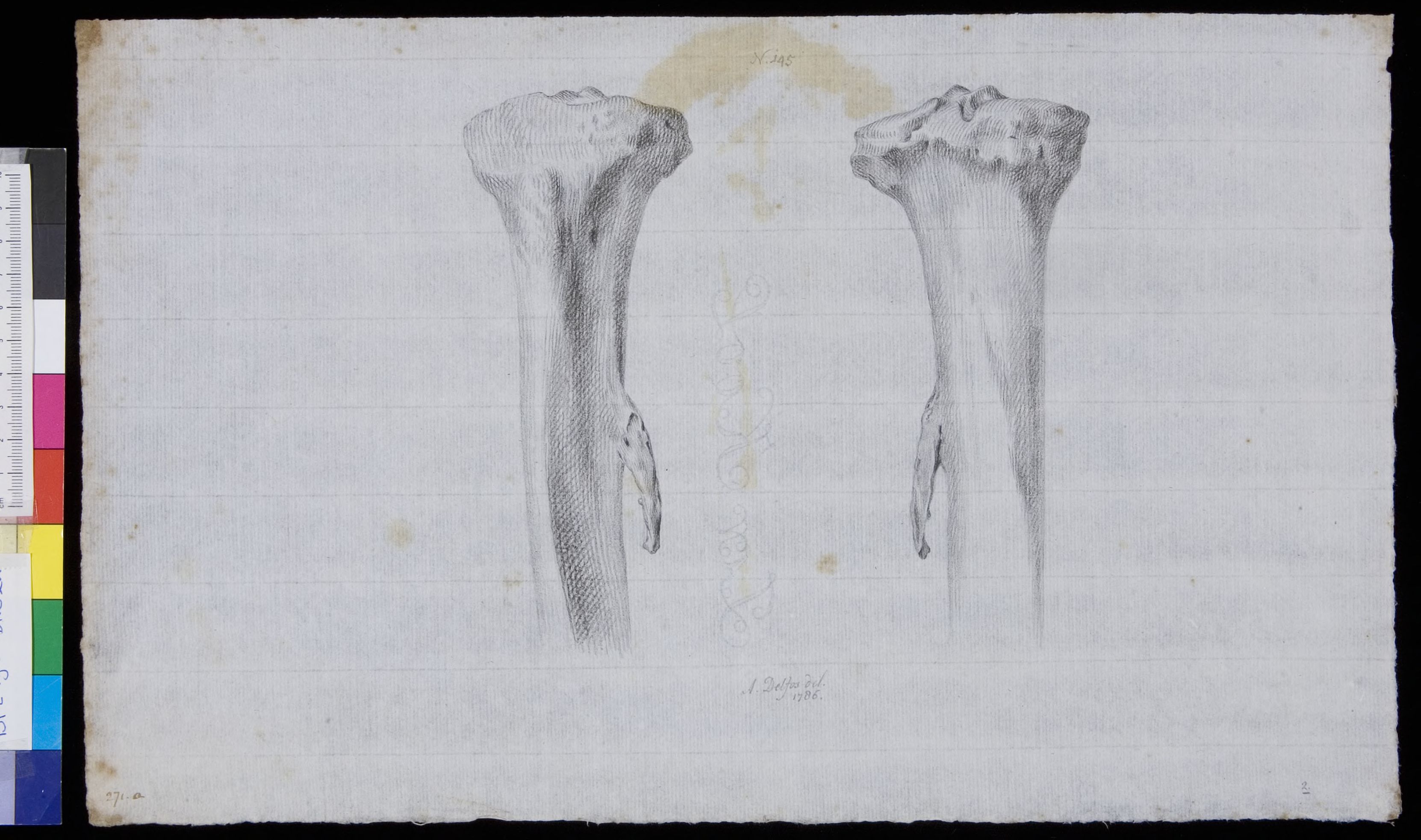 Bones