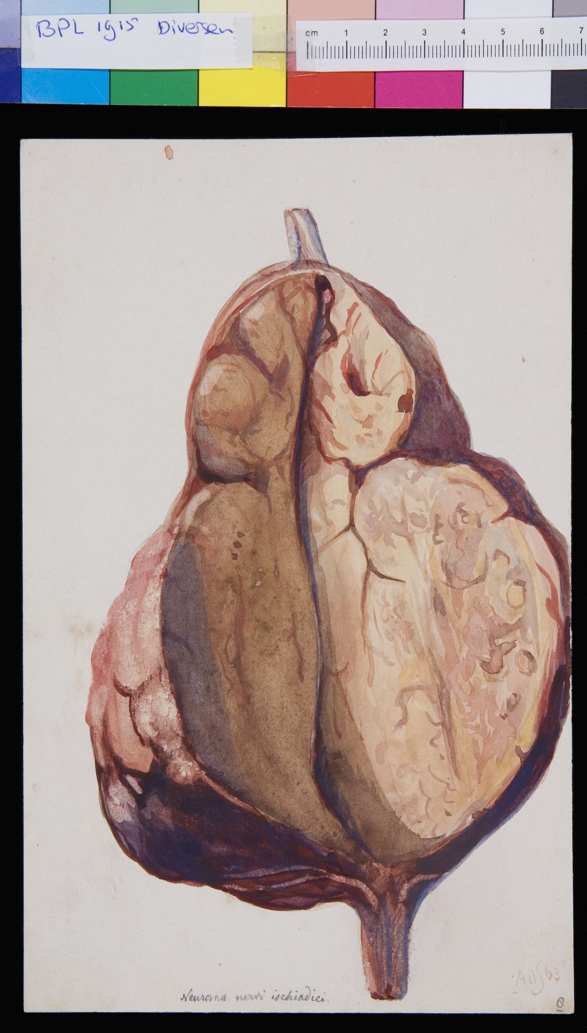 Sciatic veins