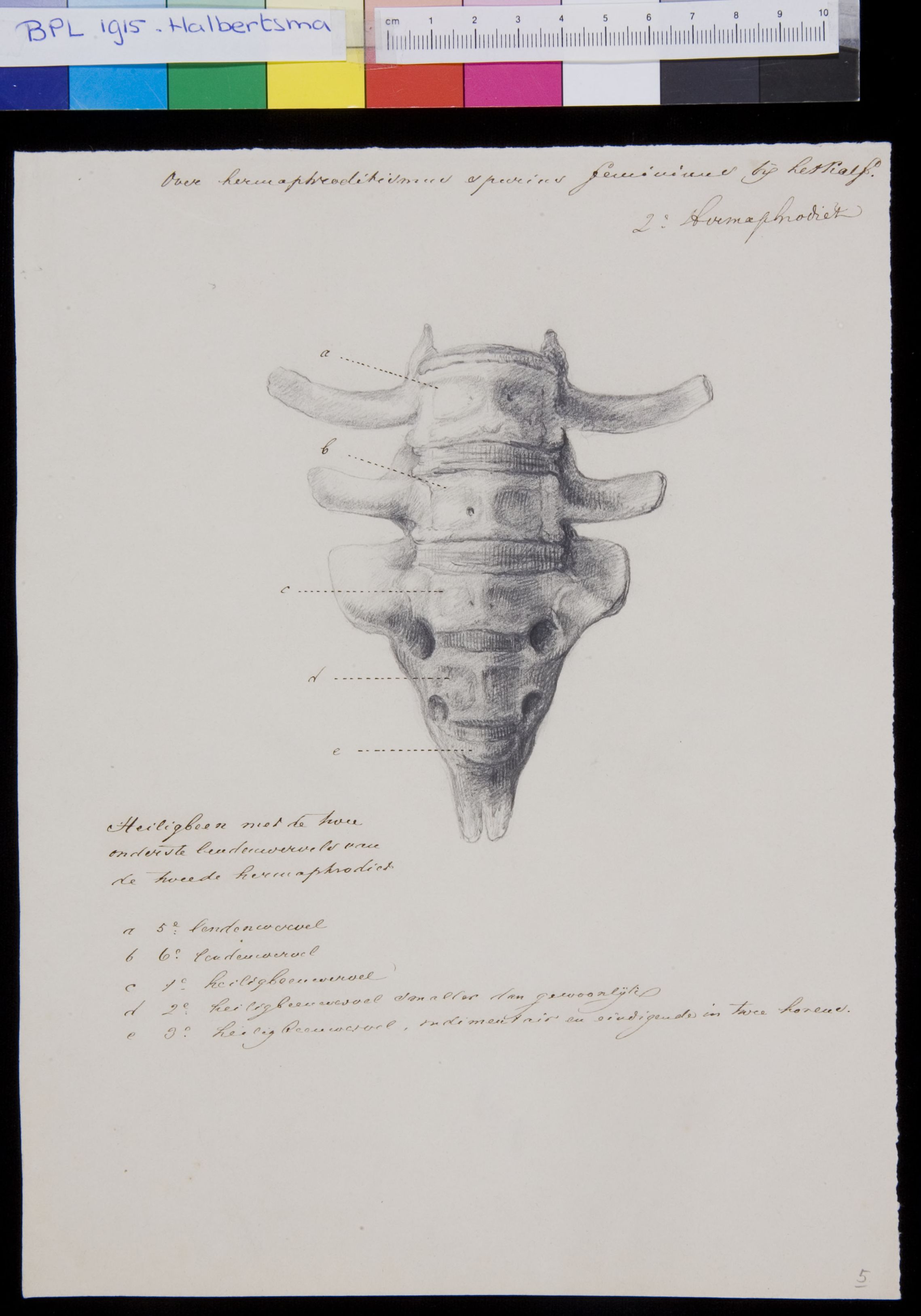 Sacrum