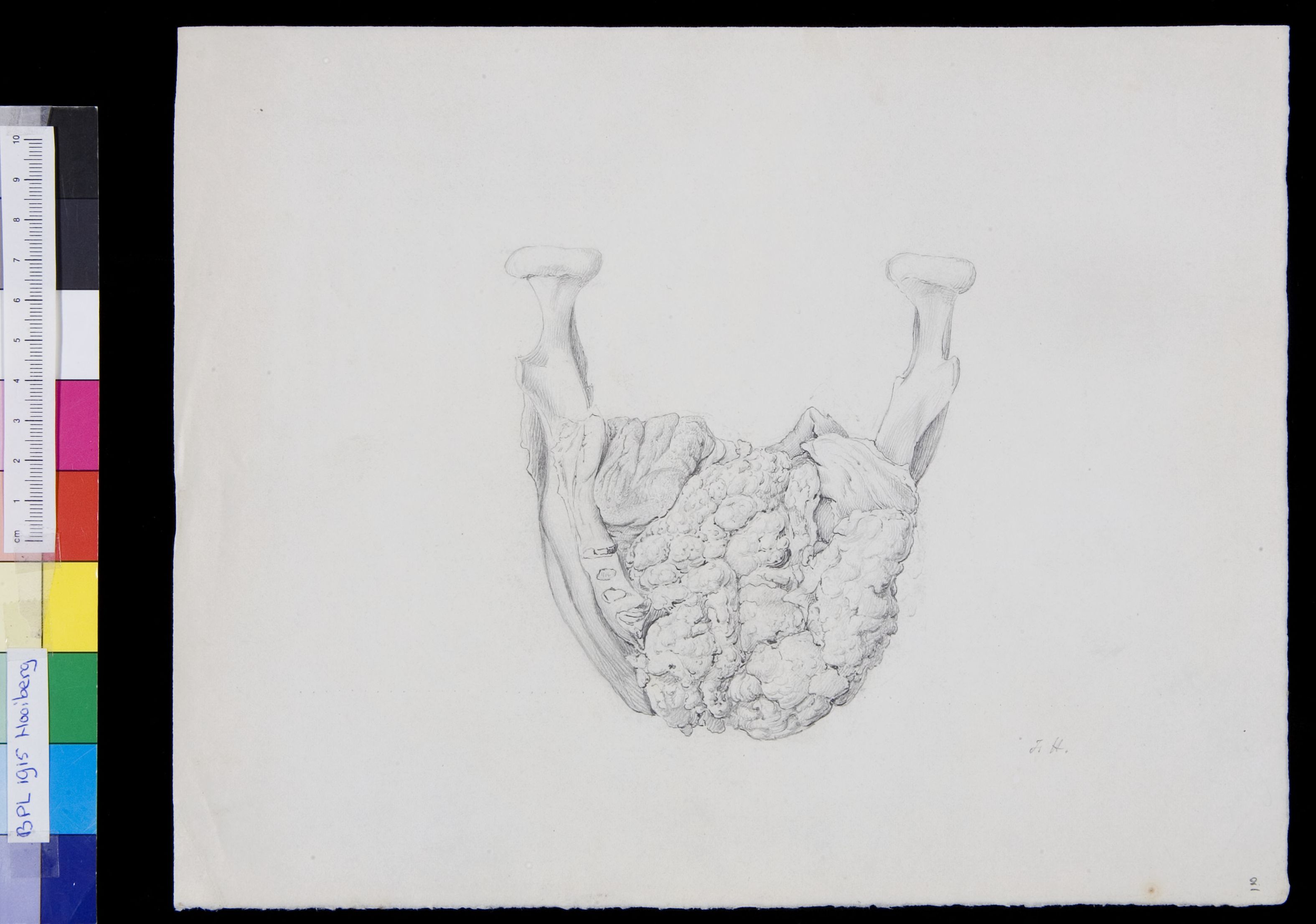Pathology, skull, lower jaw