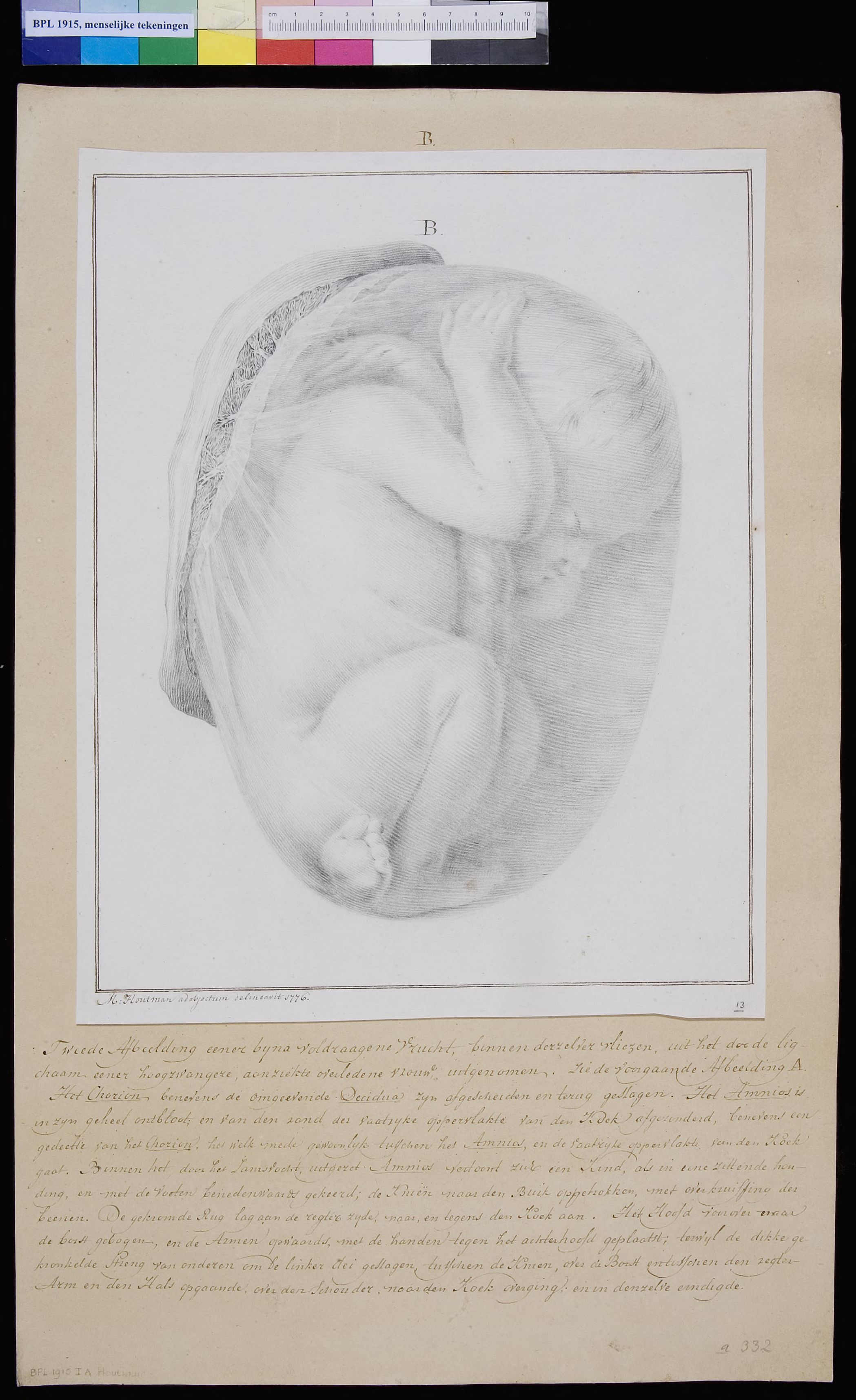 Foetus