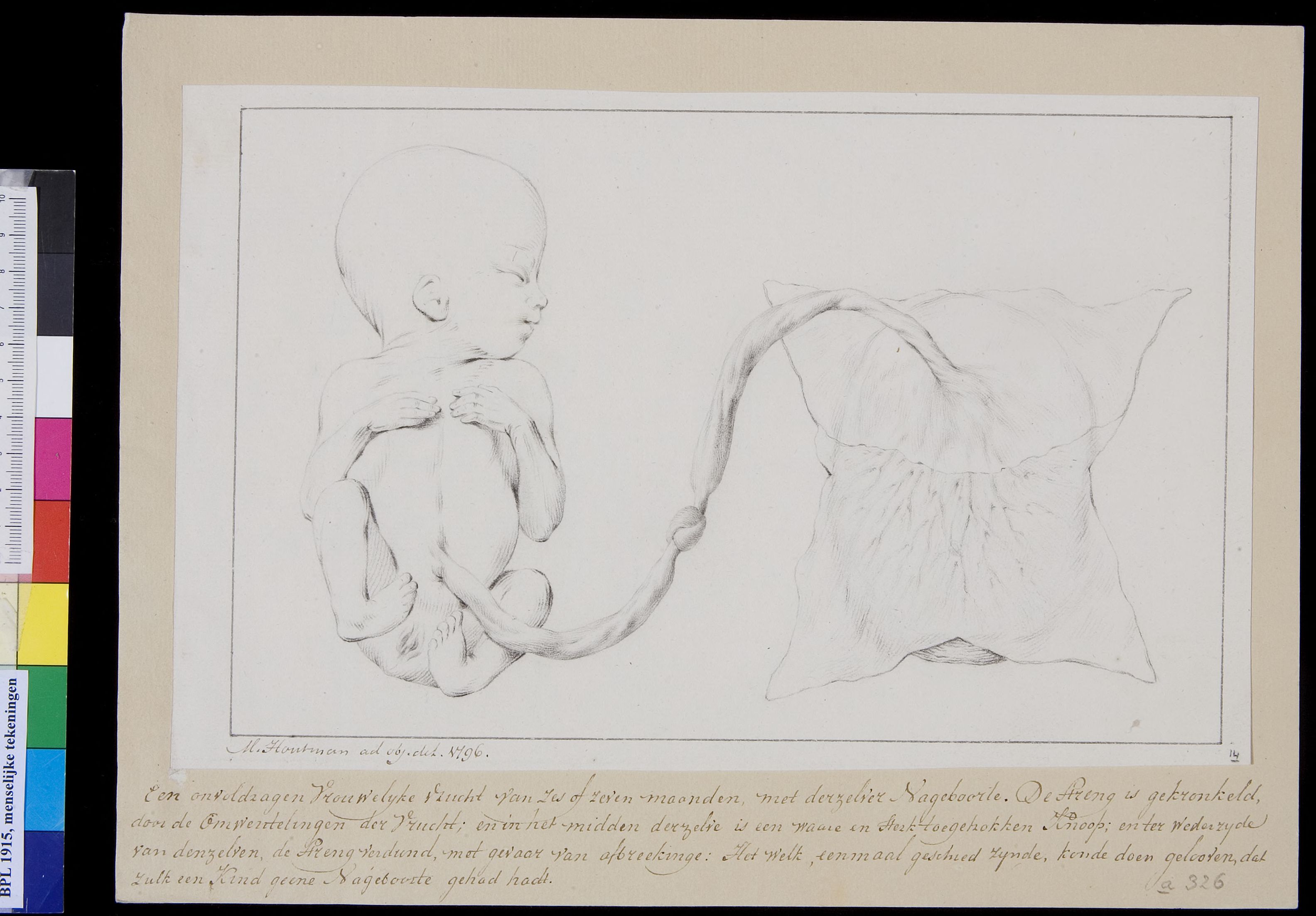 Foetus and placenta