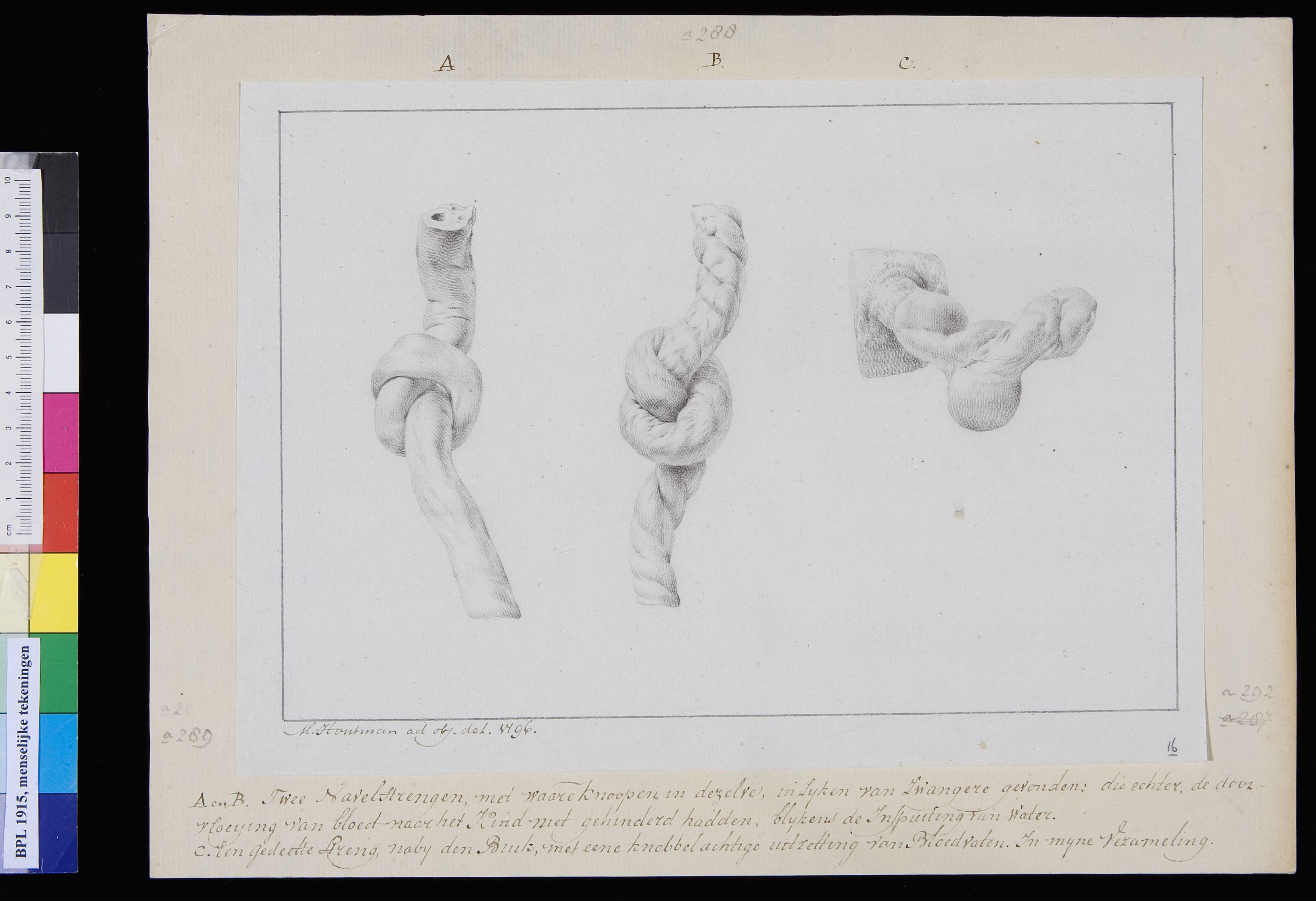 Umbilical cord