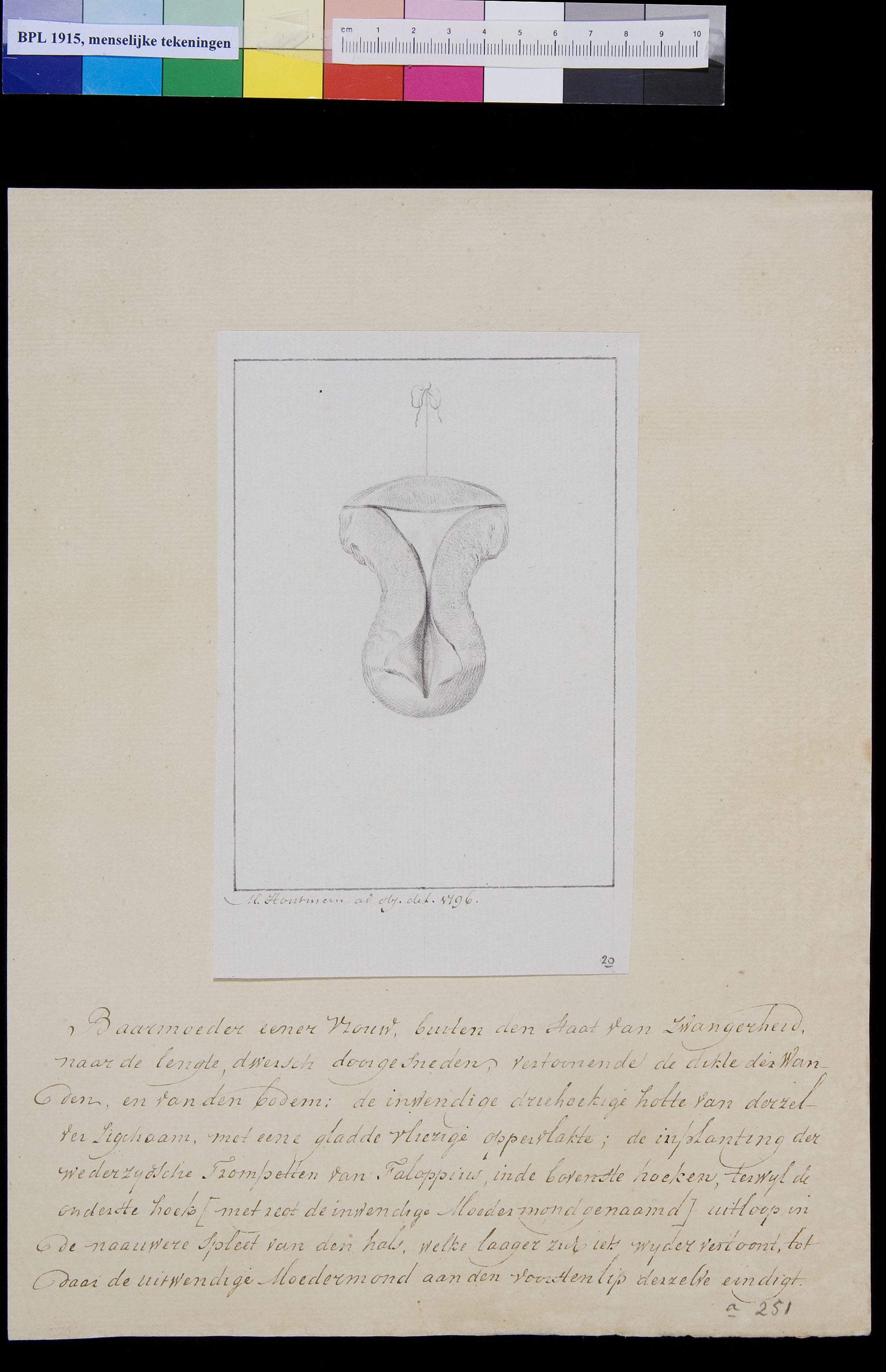 Foetus