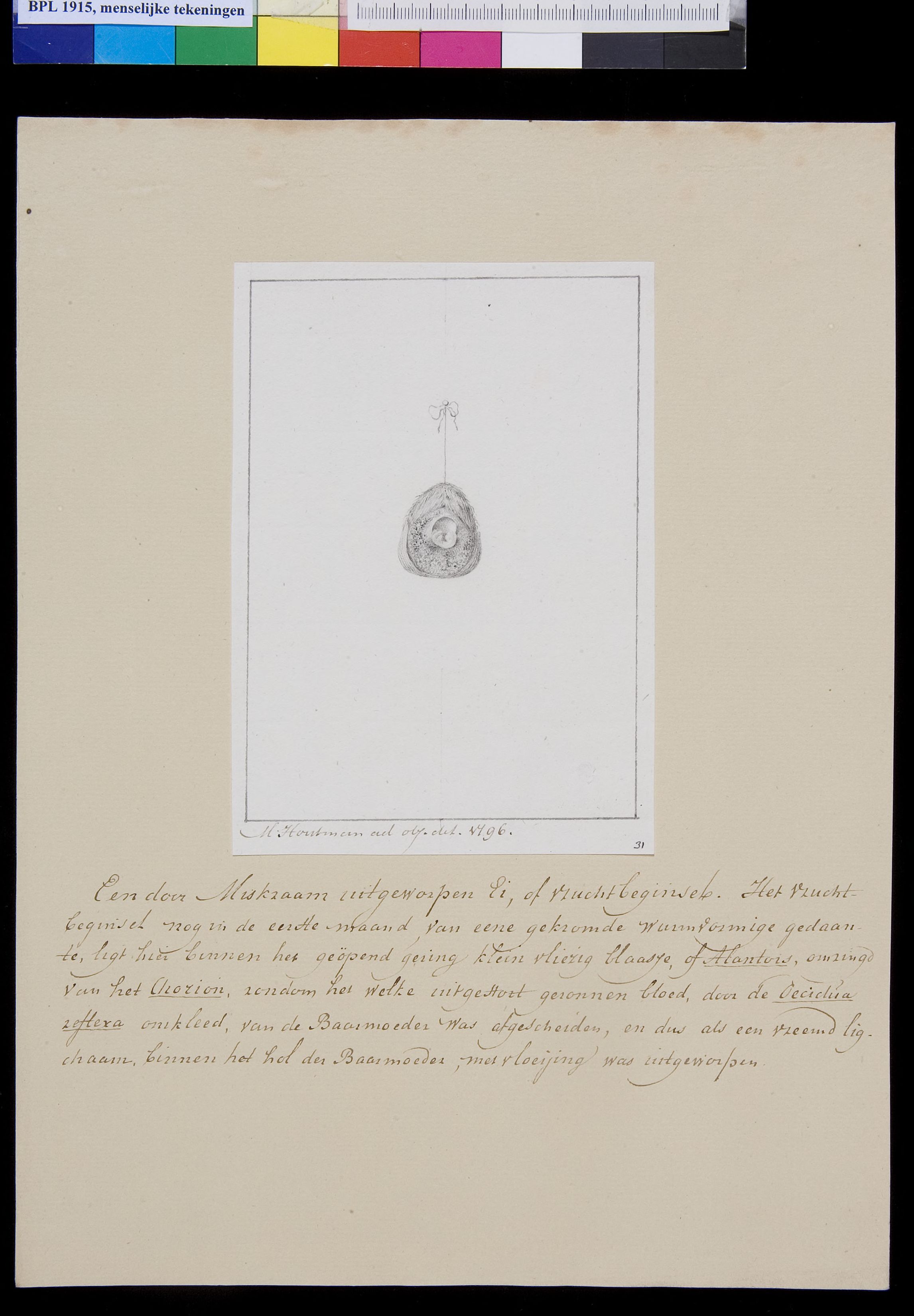 Embryo