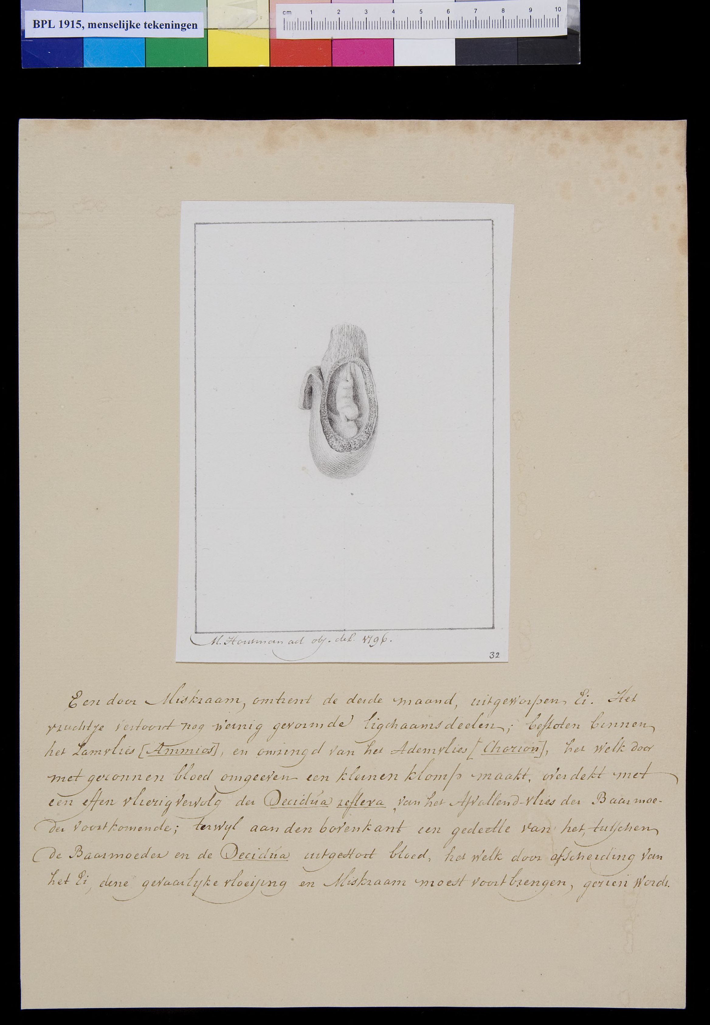Embryo