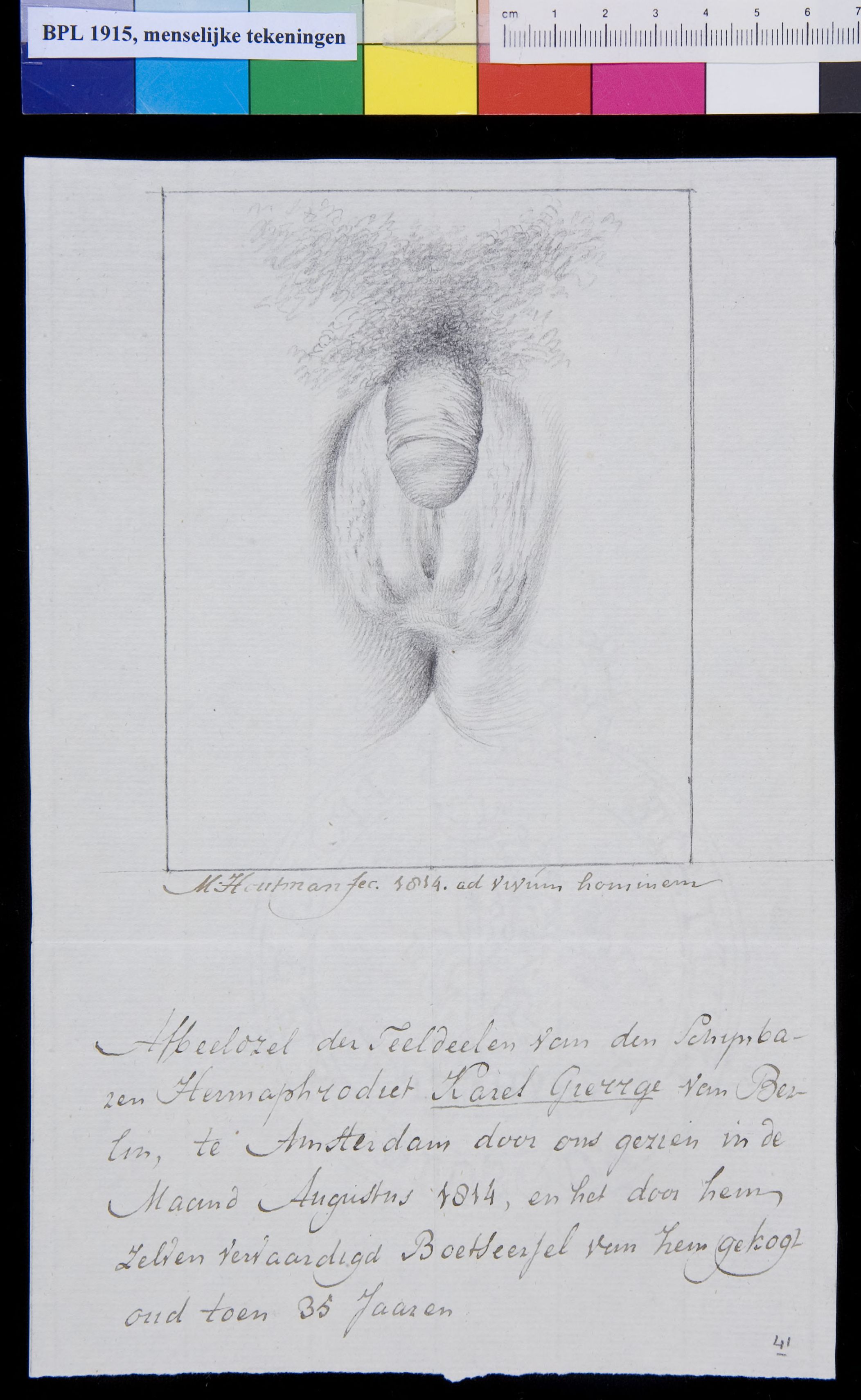 Genitals, hermaphrodite