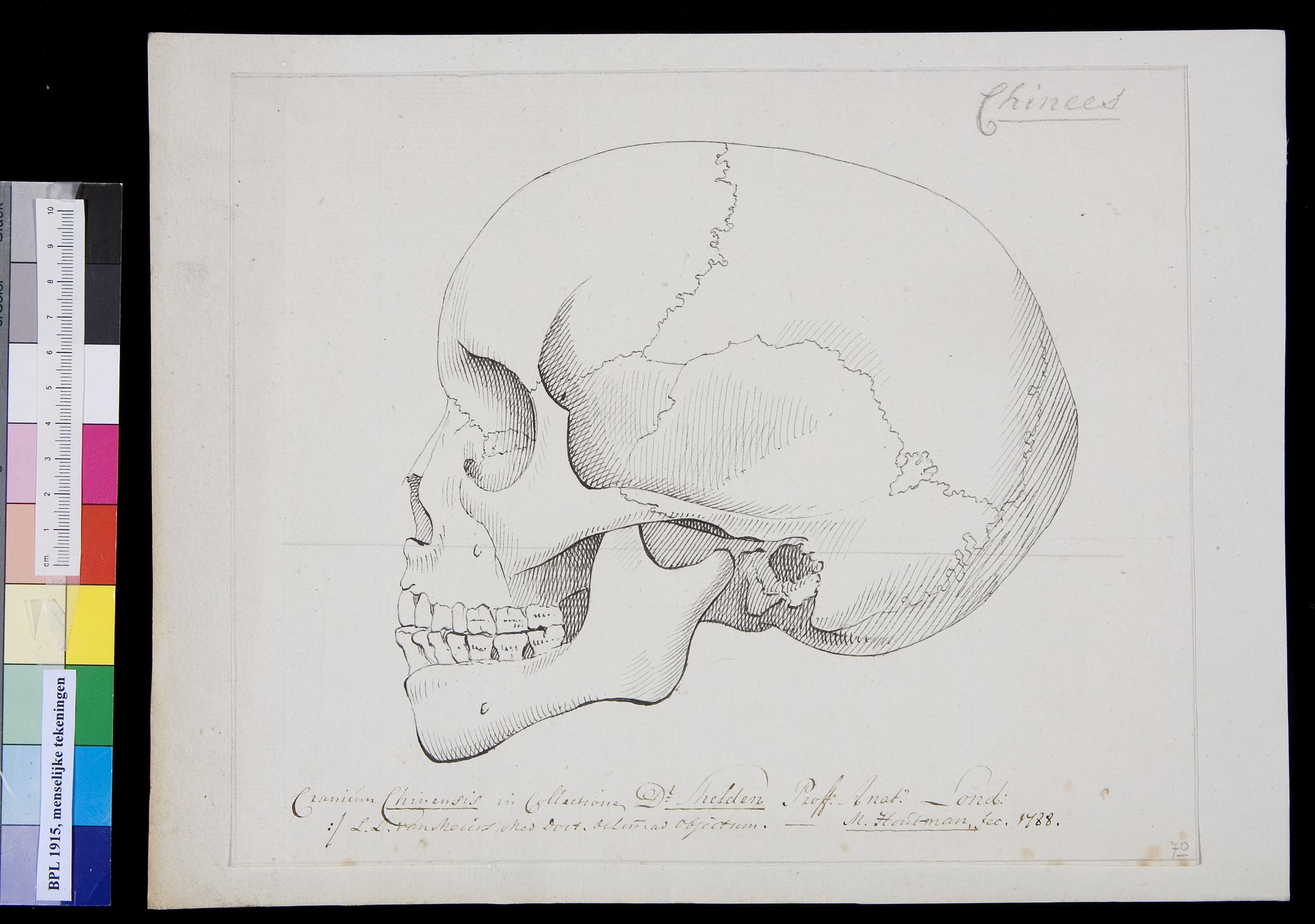Skull of a Chinese man