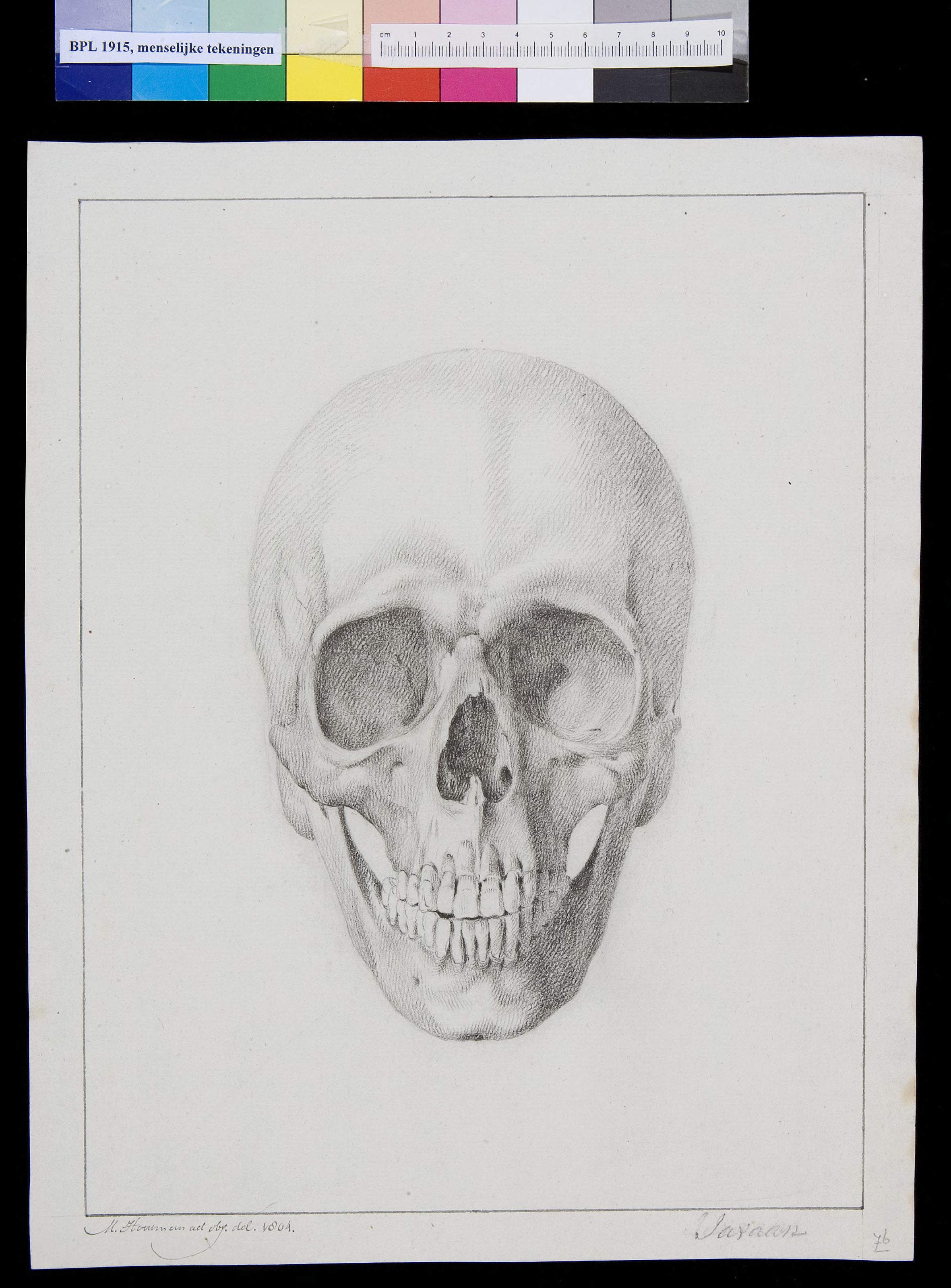 Skull of a Javanese