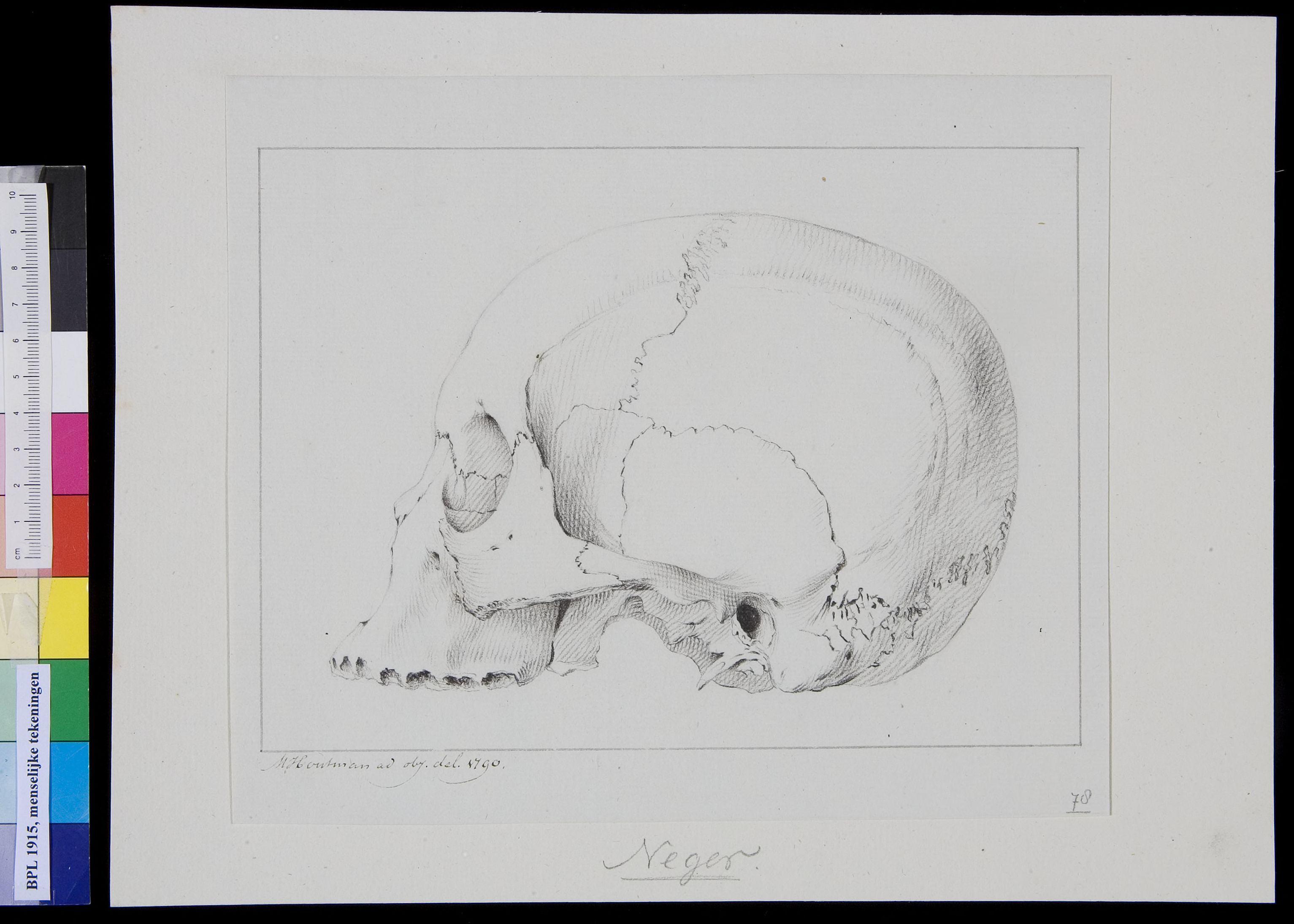 Skull of a black man