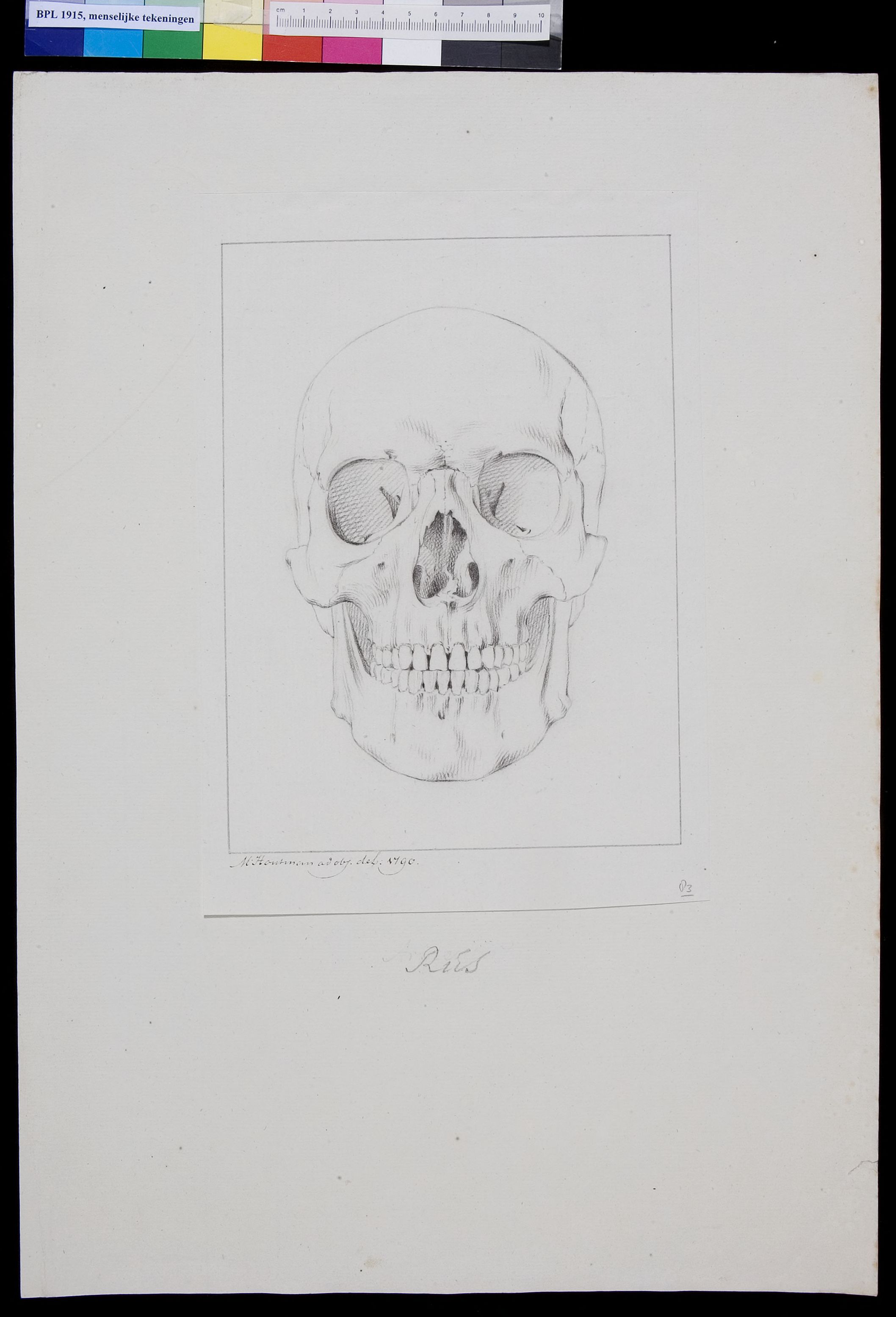 Skull of a Russian
