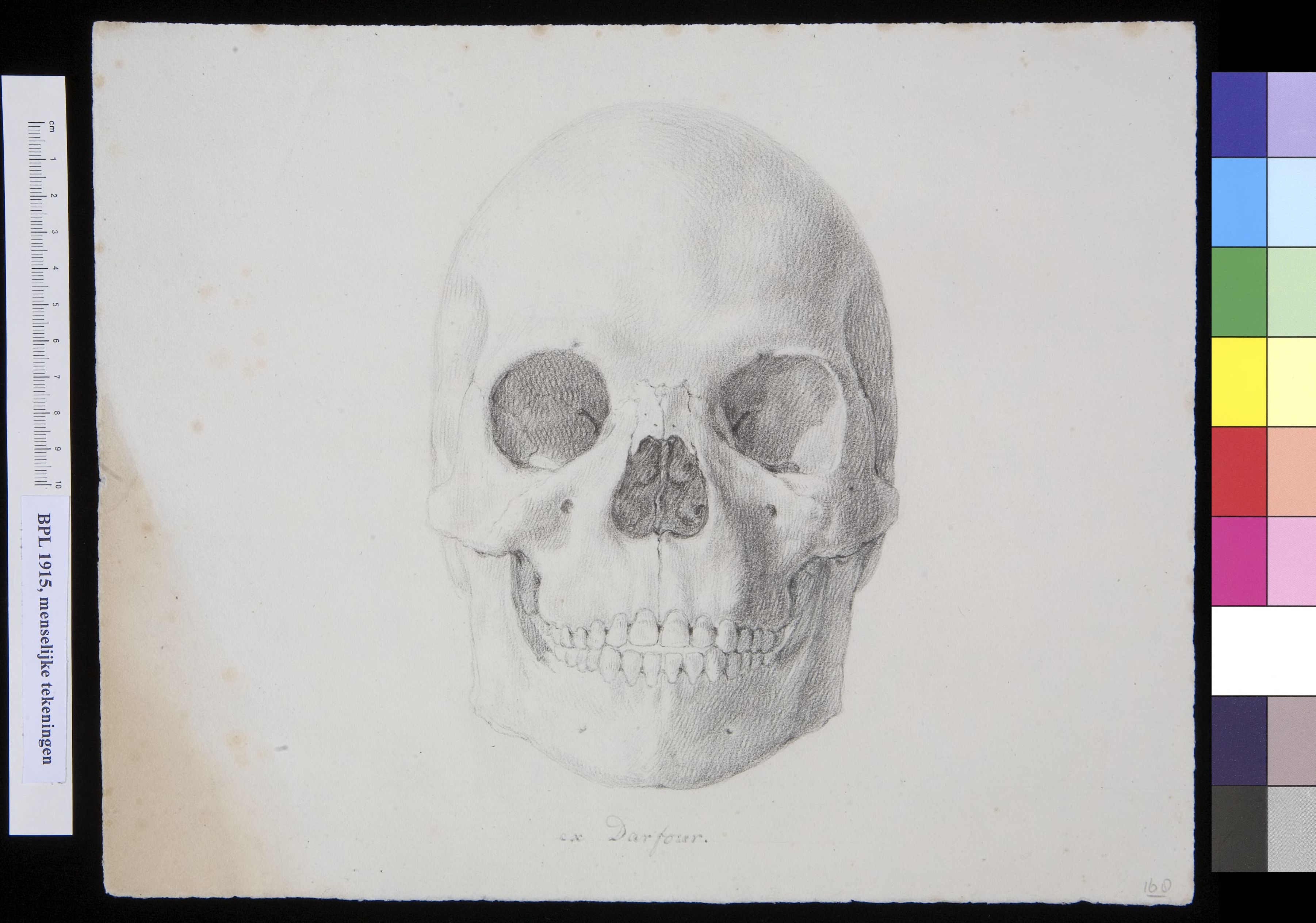 Skull of a man or woman from Darfour, frontal view