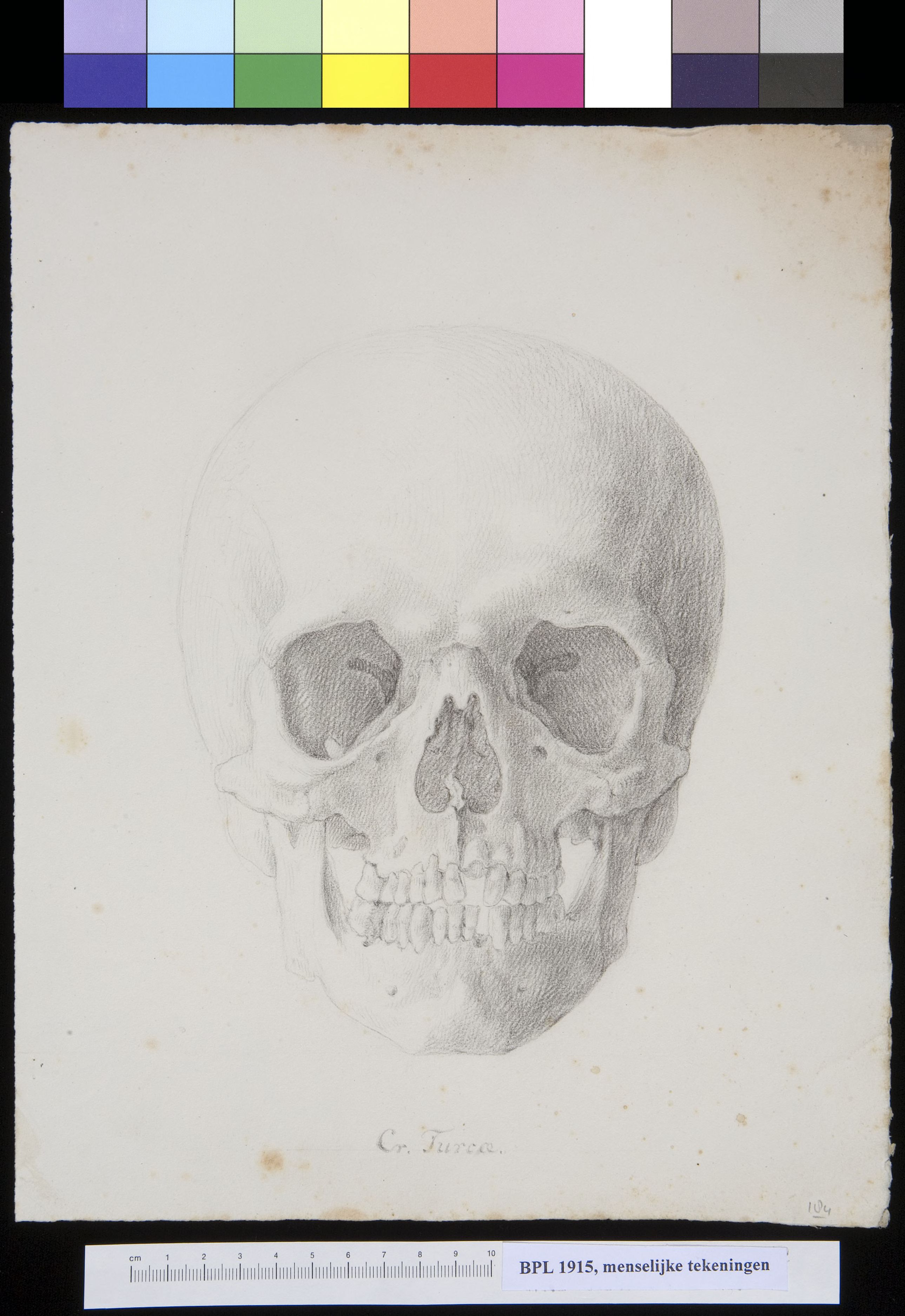 Skull of a man or woman from Turkey, frontal view