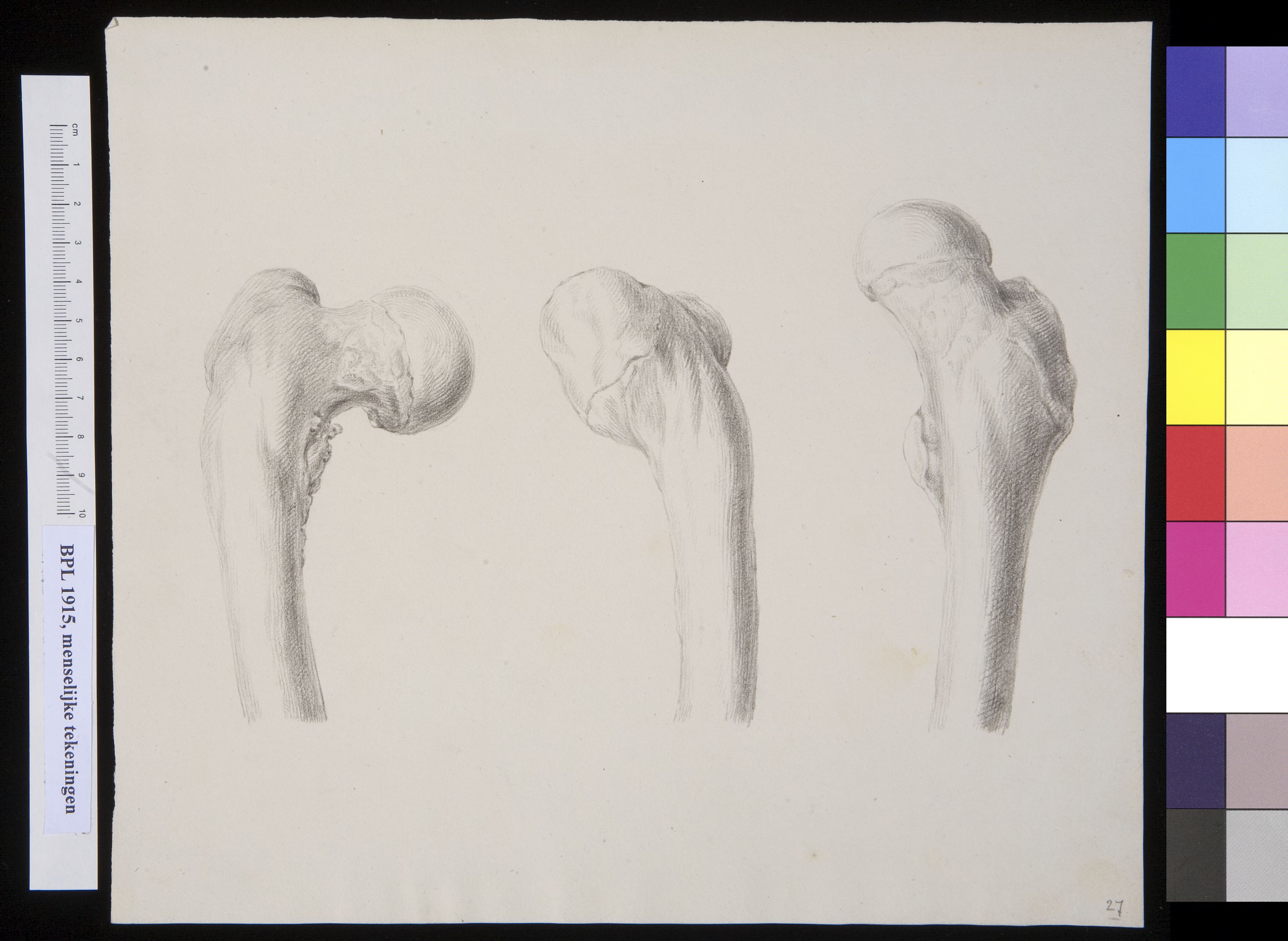Femur (thigh bone)