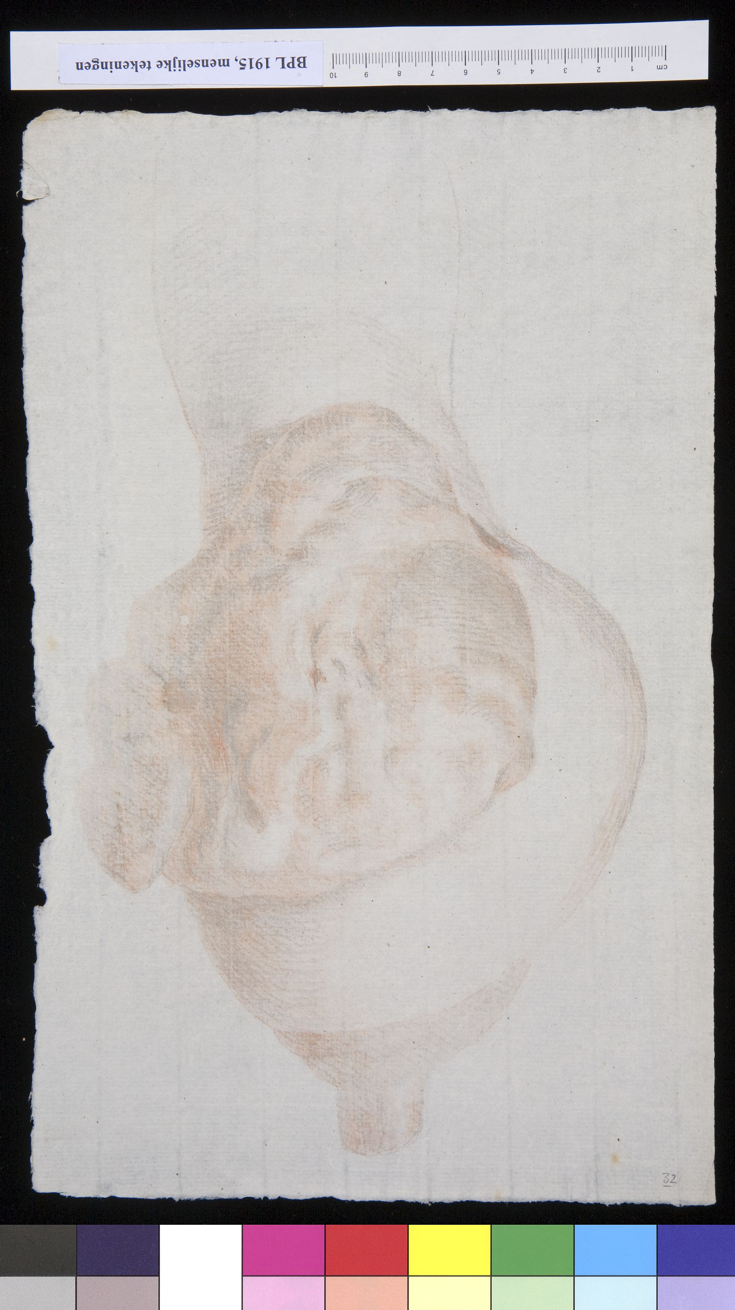 Tumor in a bone