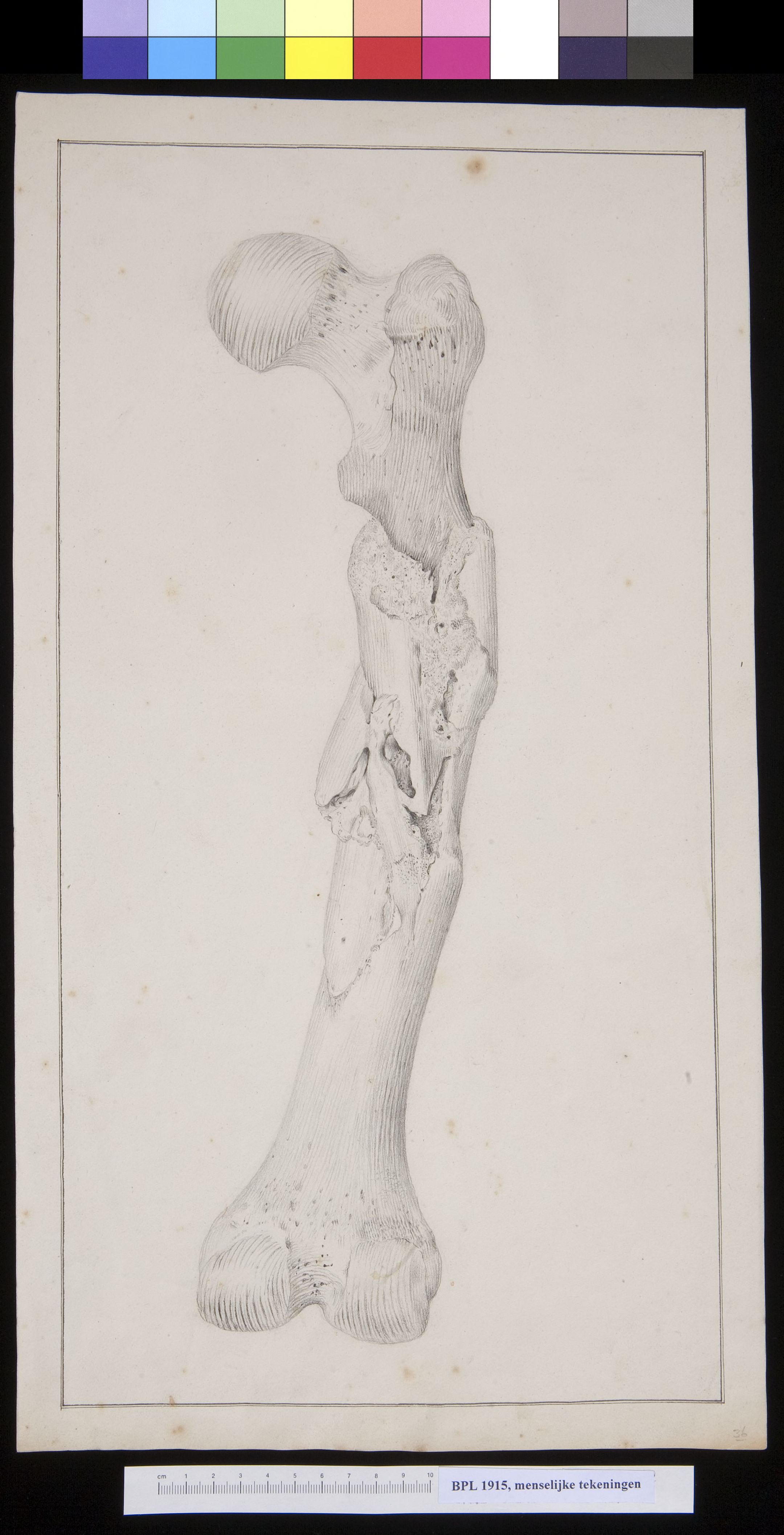 Femur (thigh bone)