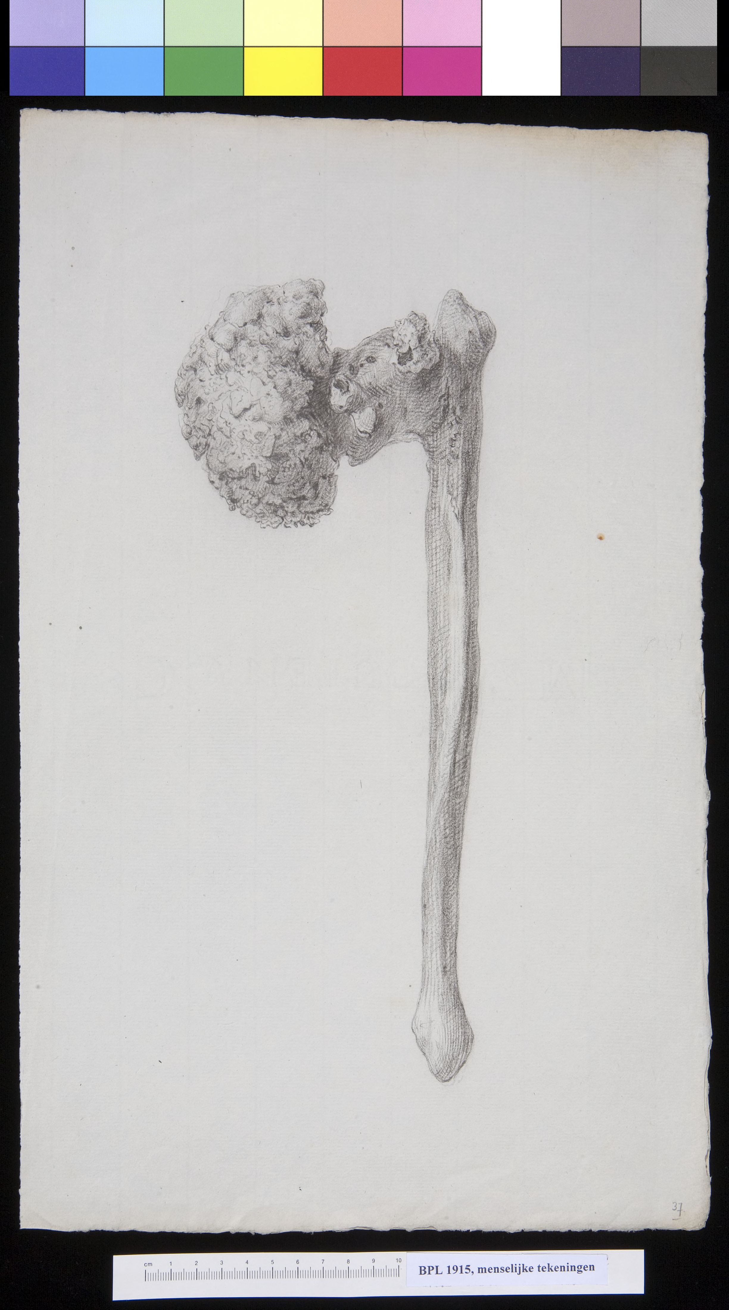 Femur (thigh bone)
