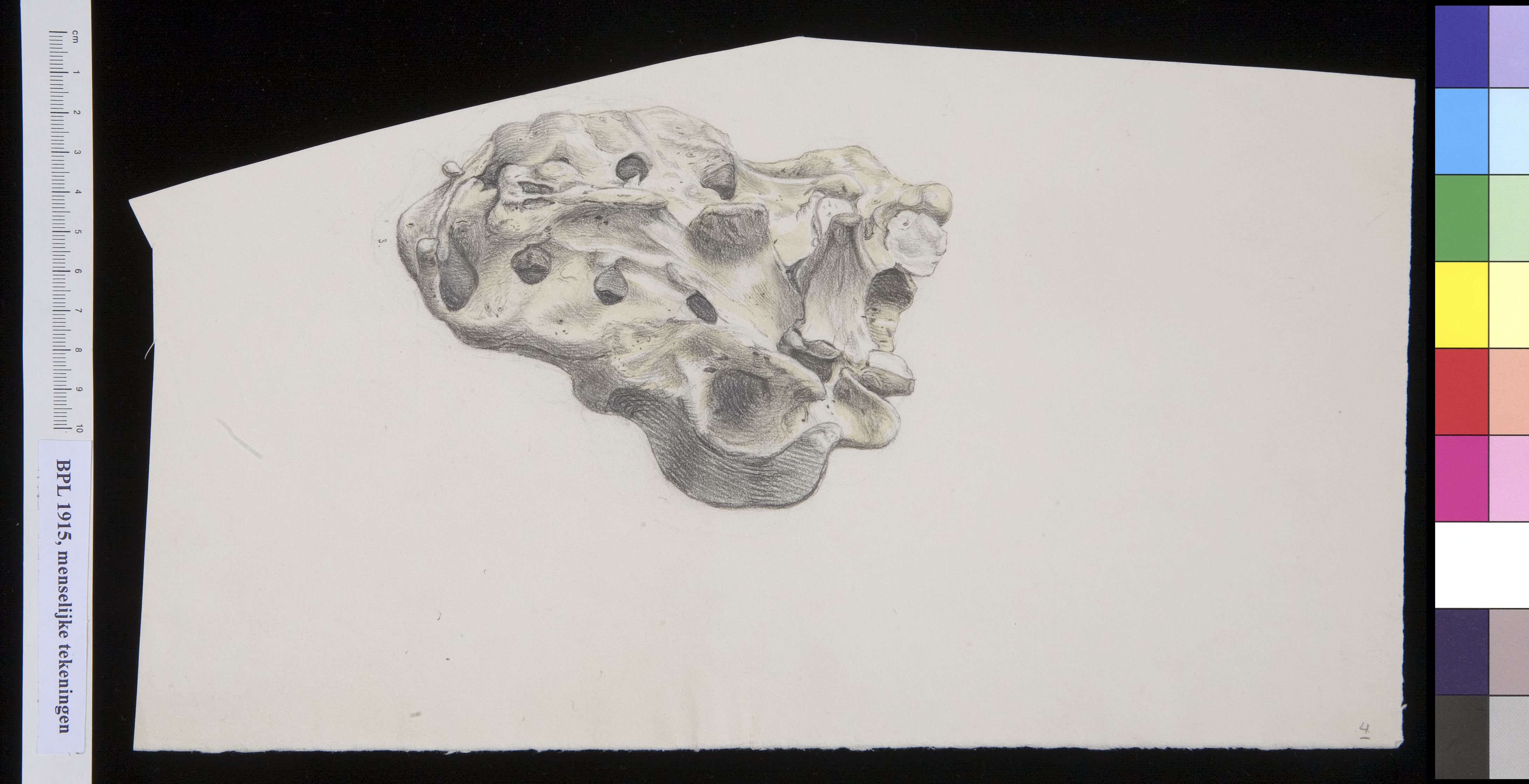 Undetermined bone
