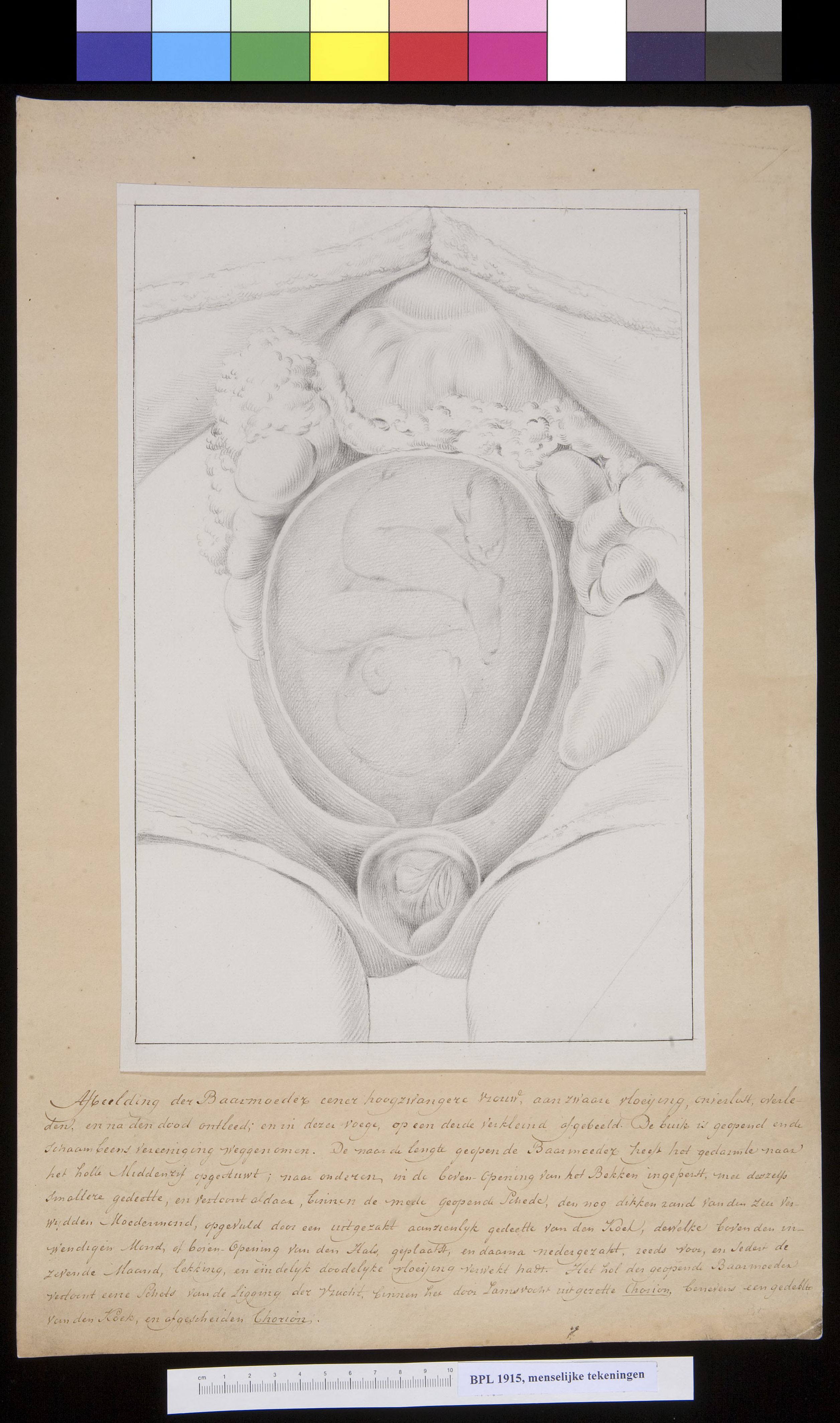 Foetus in the womb (uterus)
