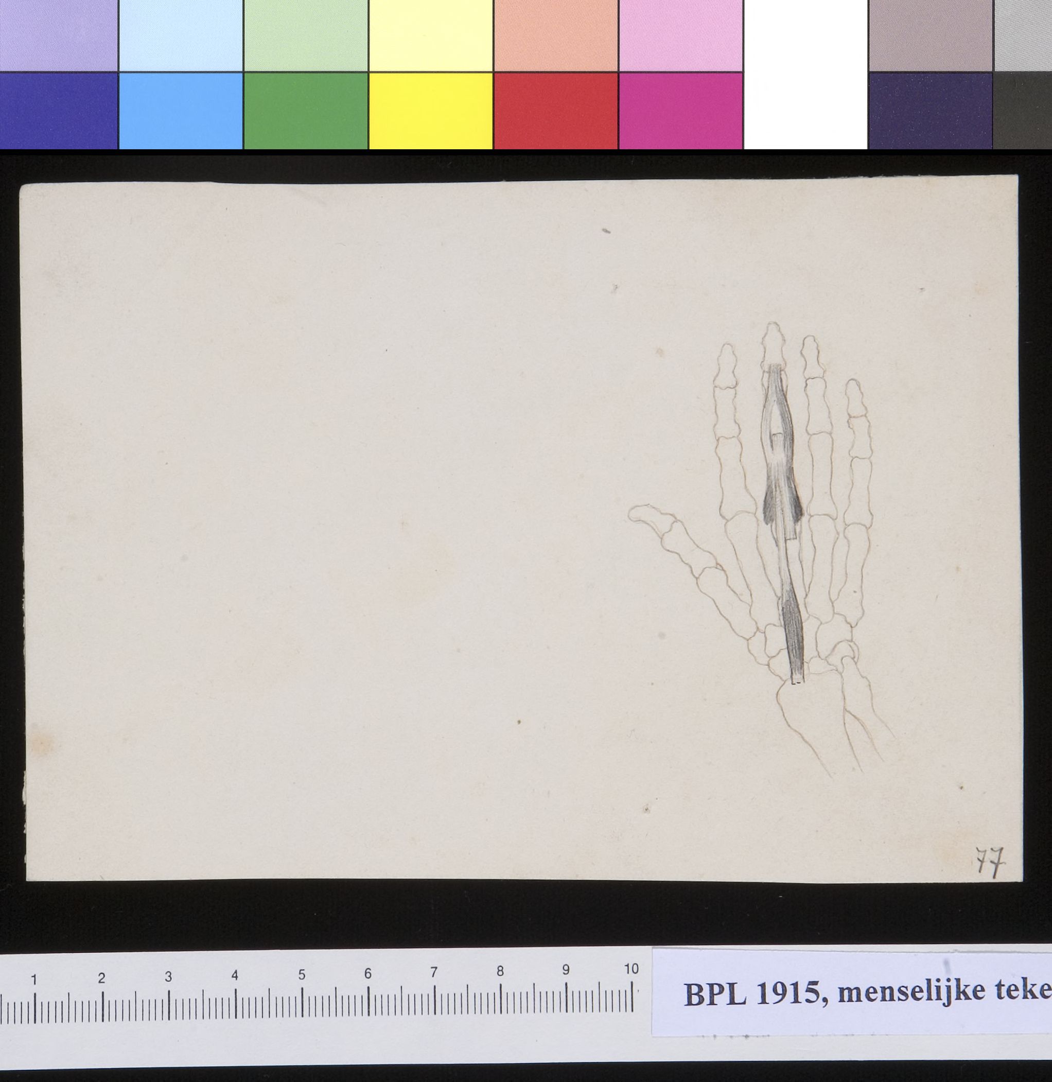 Muscles of a finger