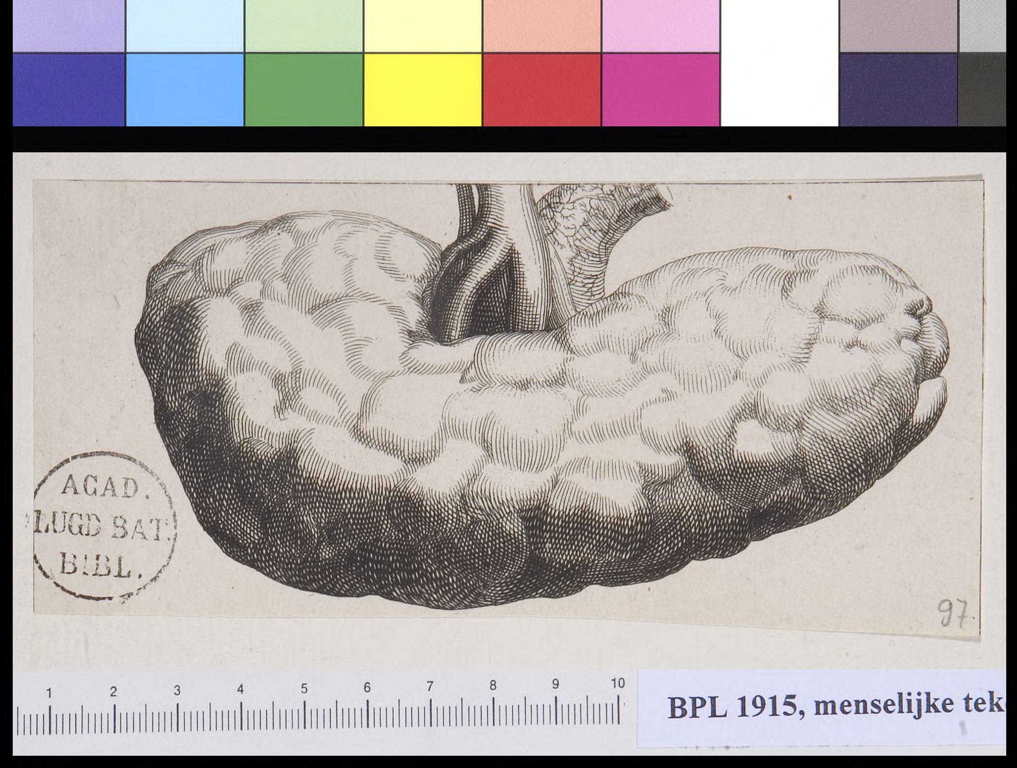 Kidney