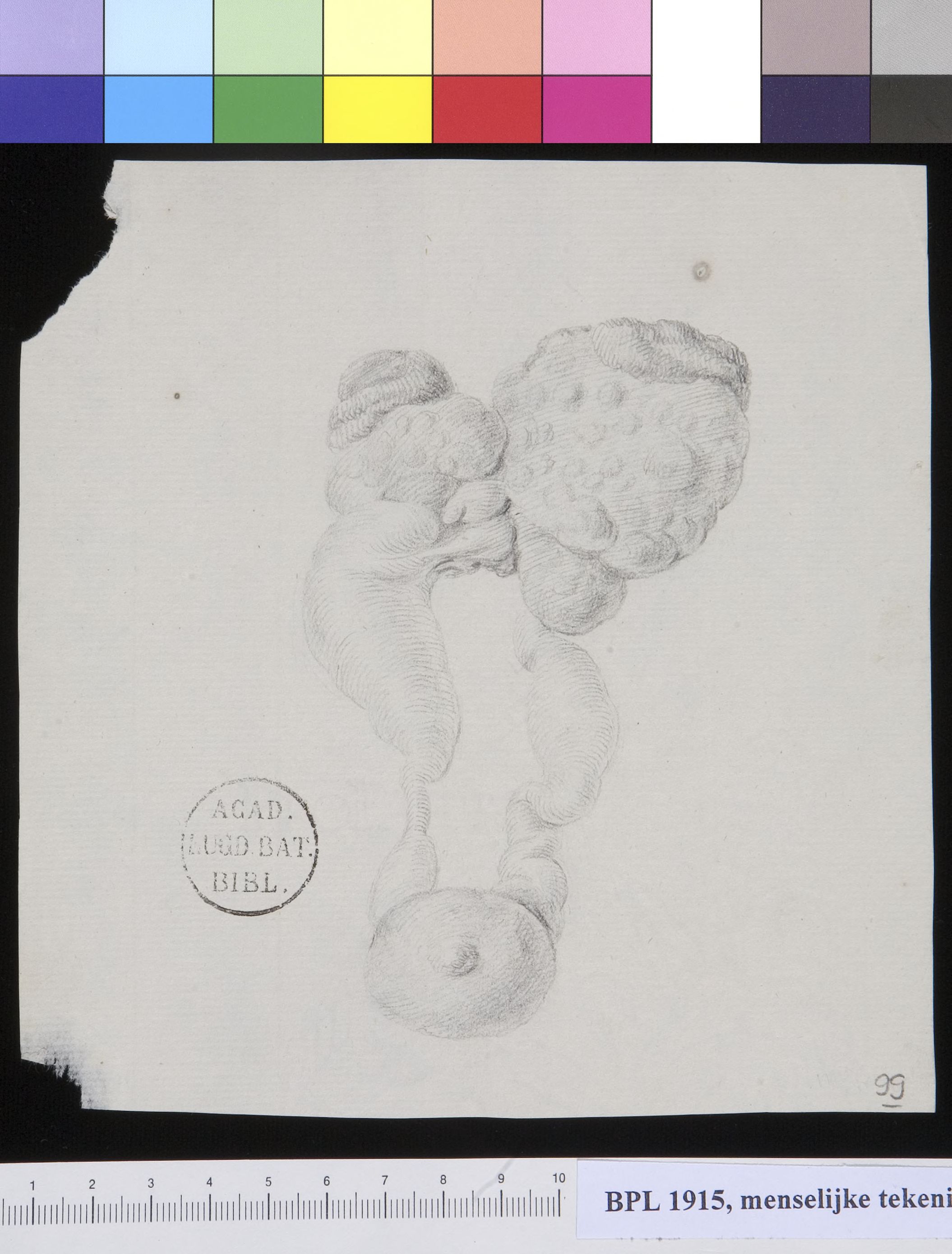 Kidney