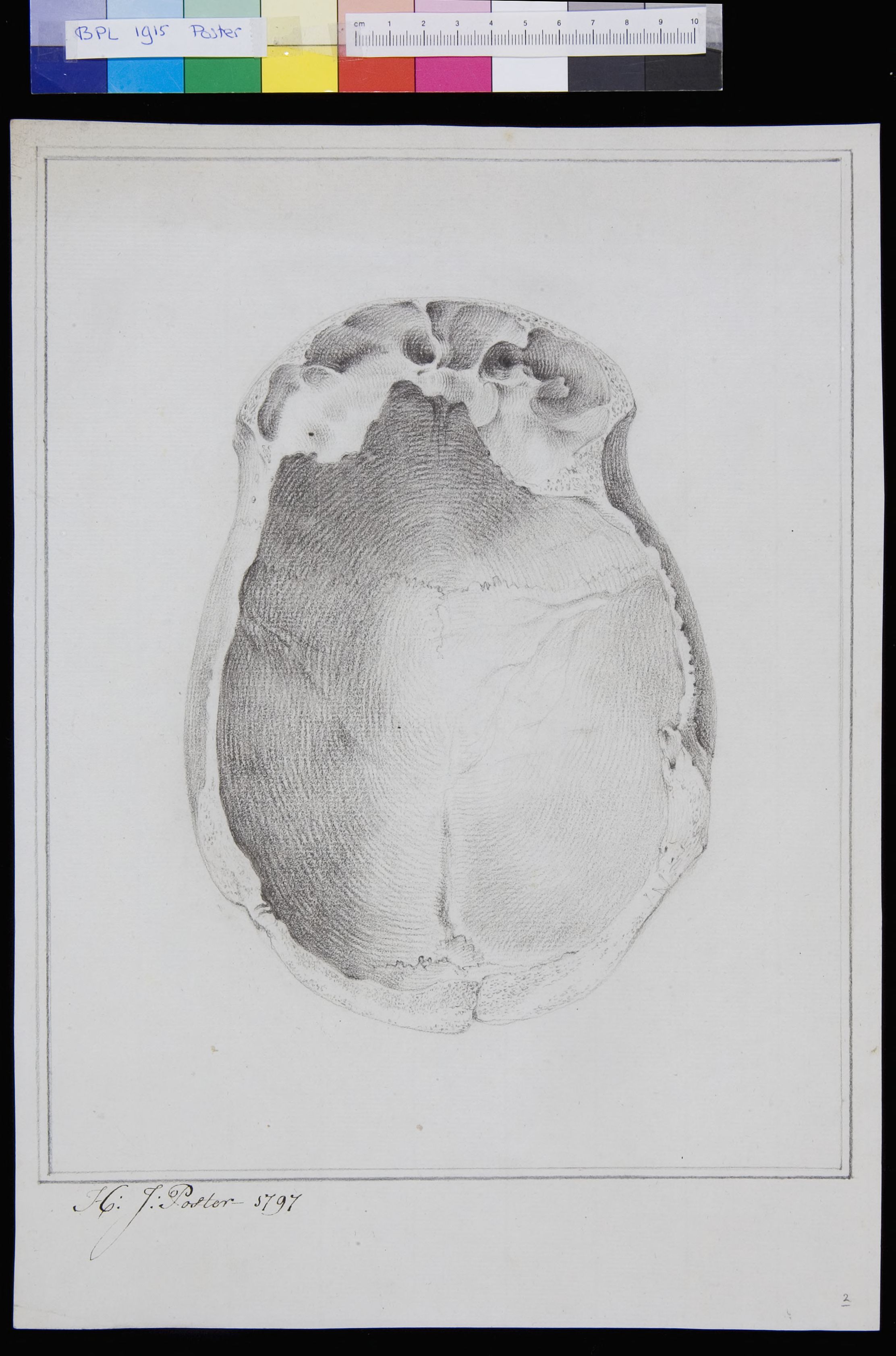Skull (calvaria)