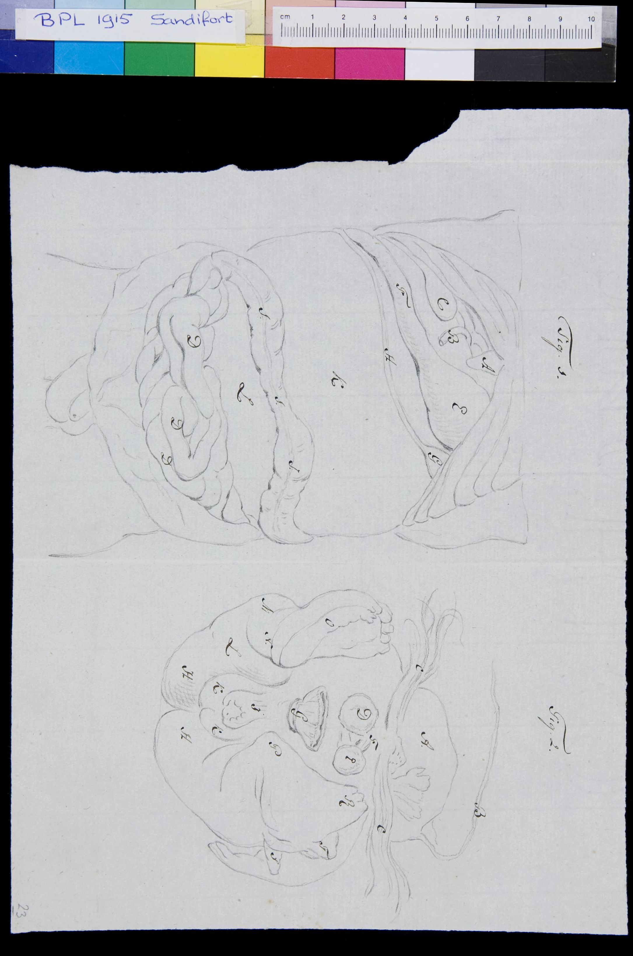 Abdomen, organs (legend)
