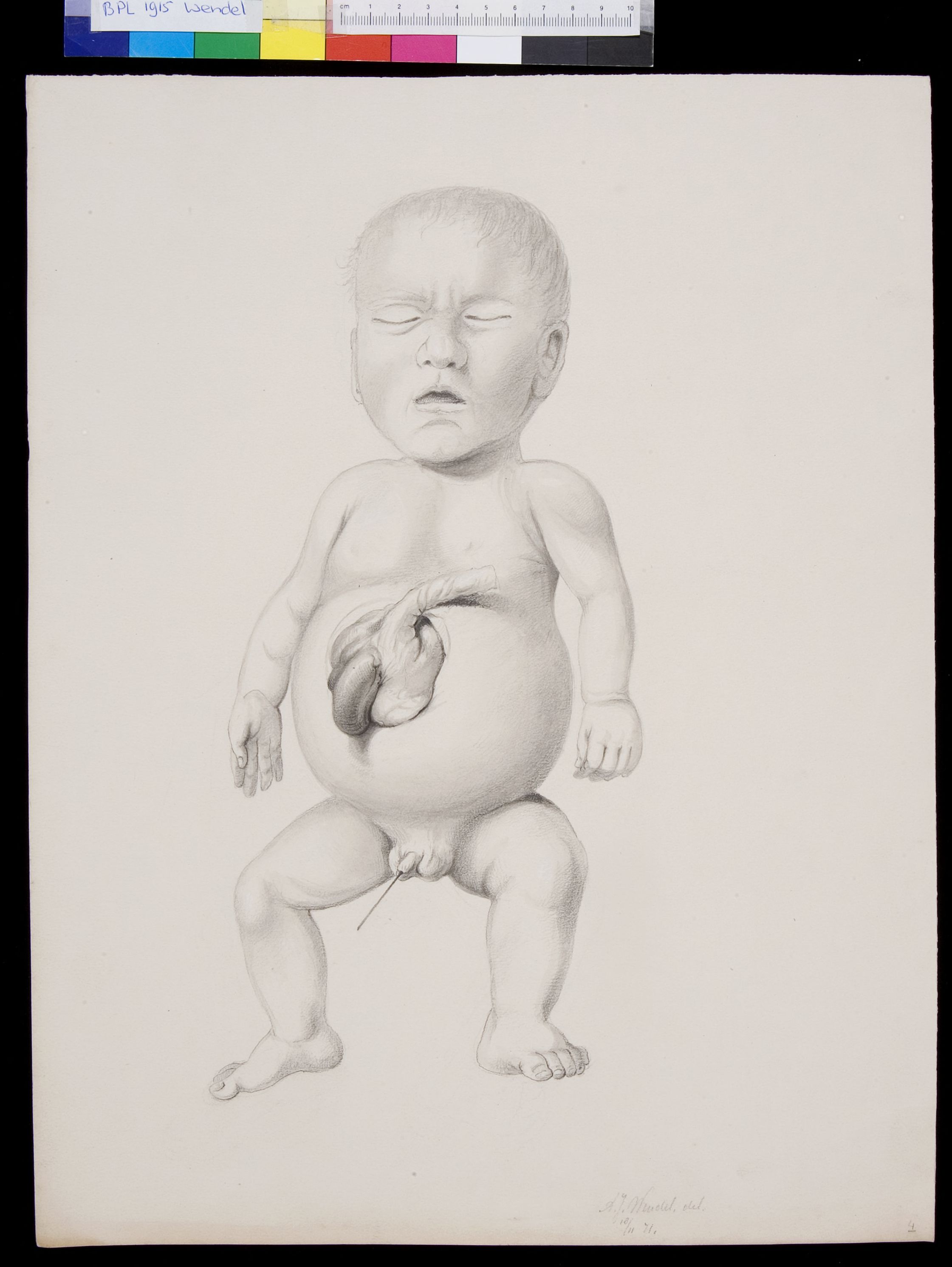 Foetus