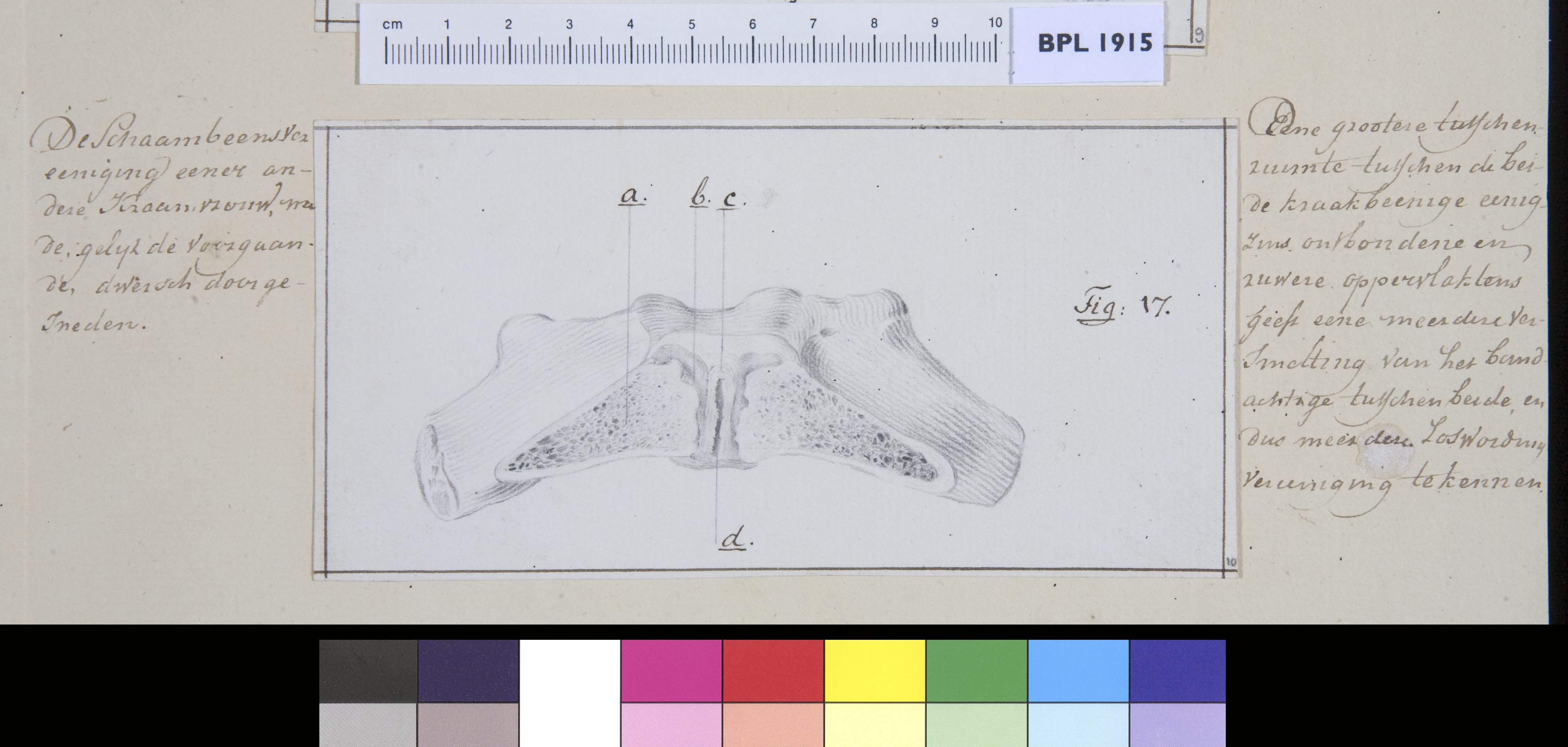 Pubis bone
