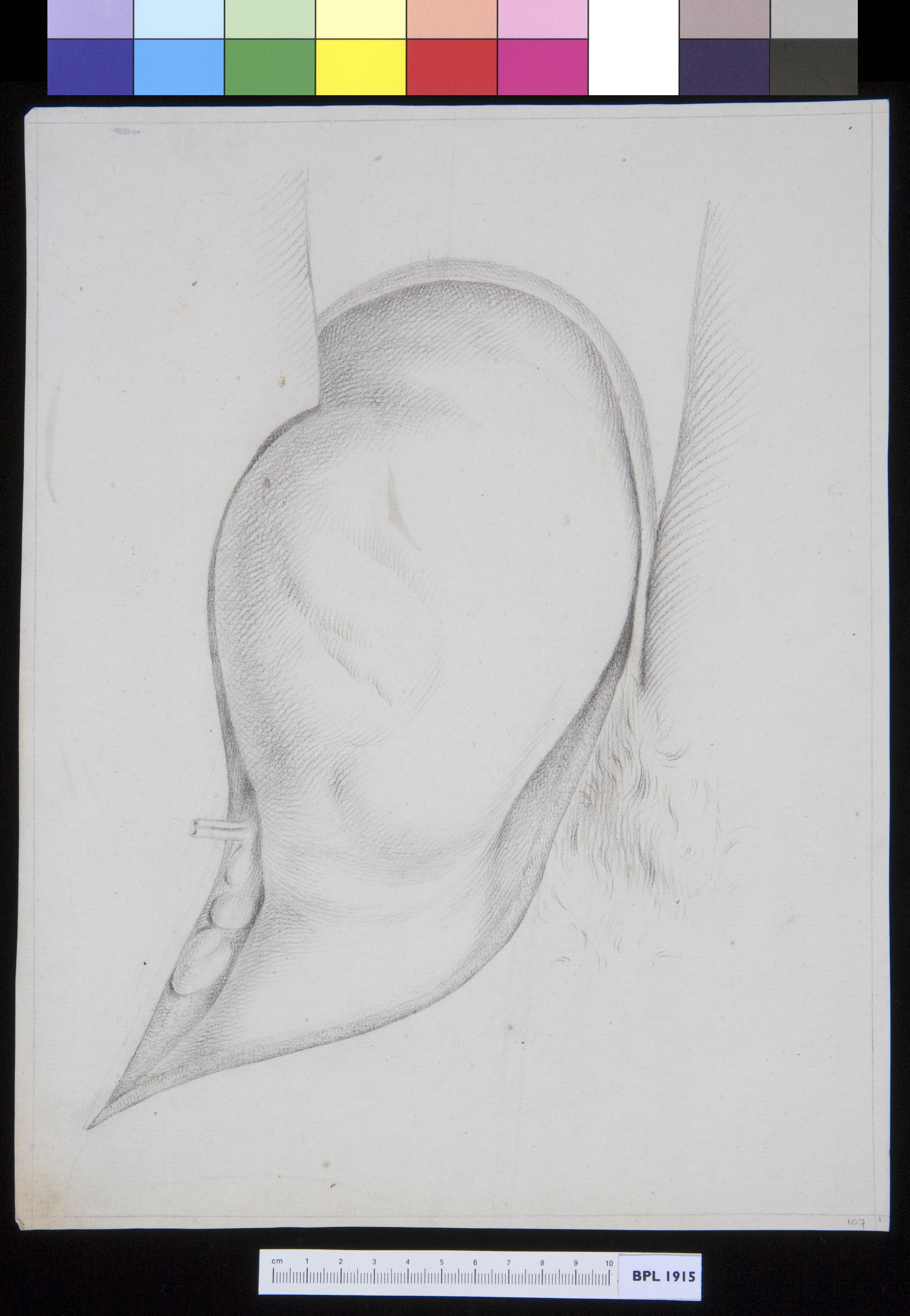 Inguinal hernia