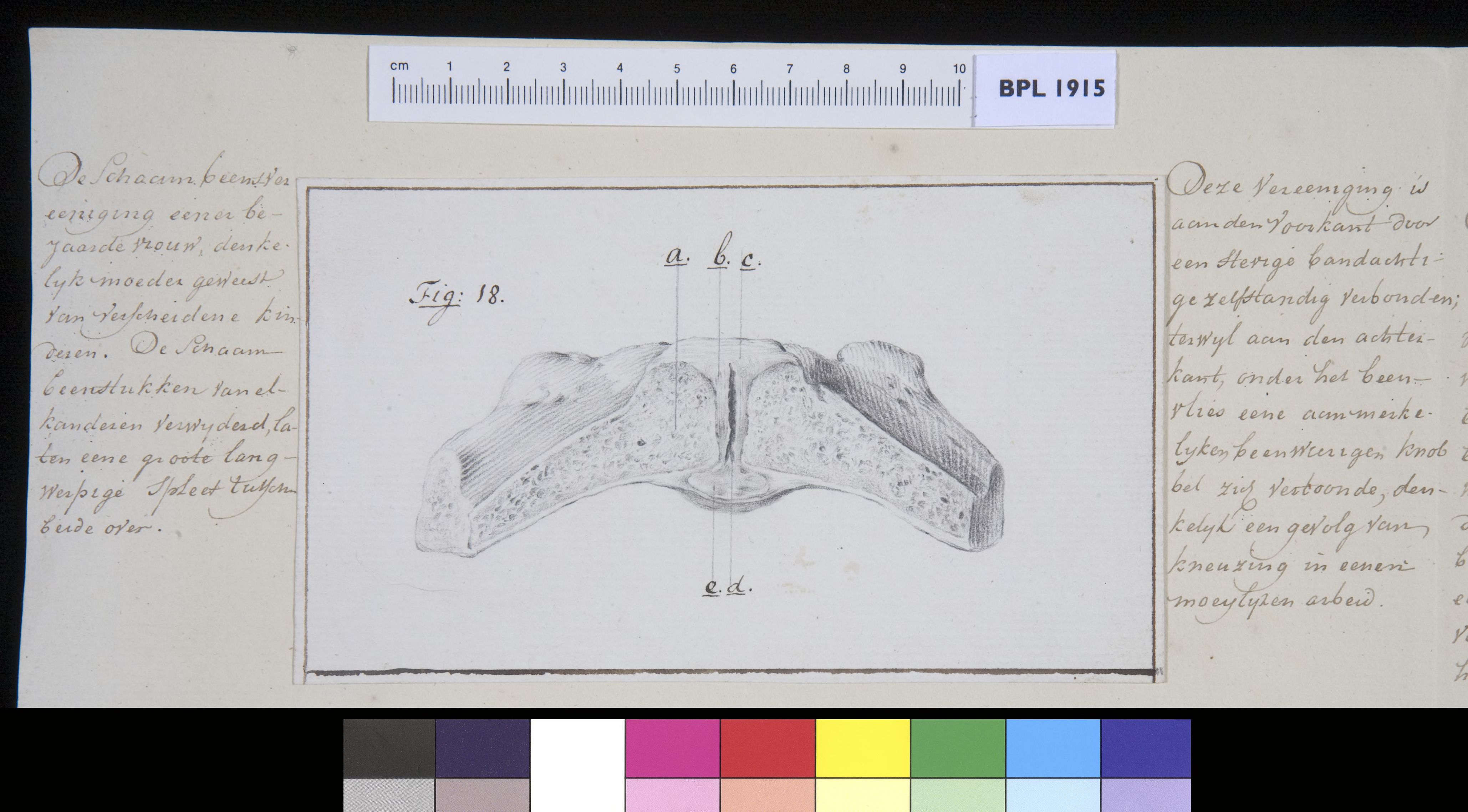 Pubis bone